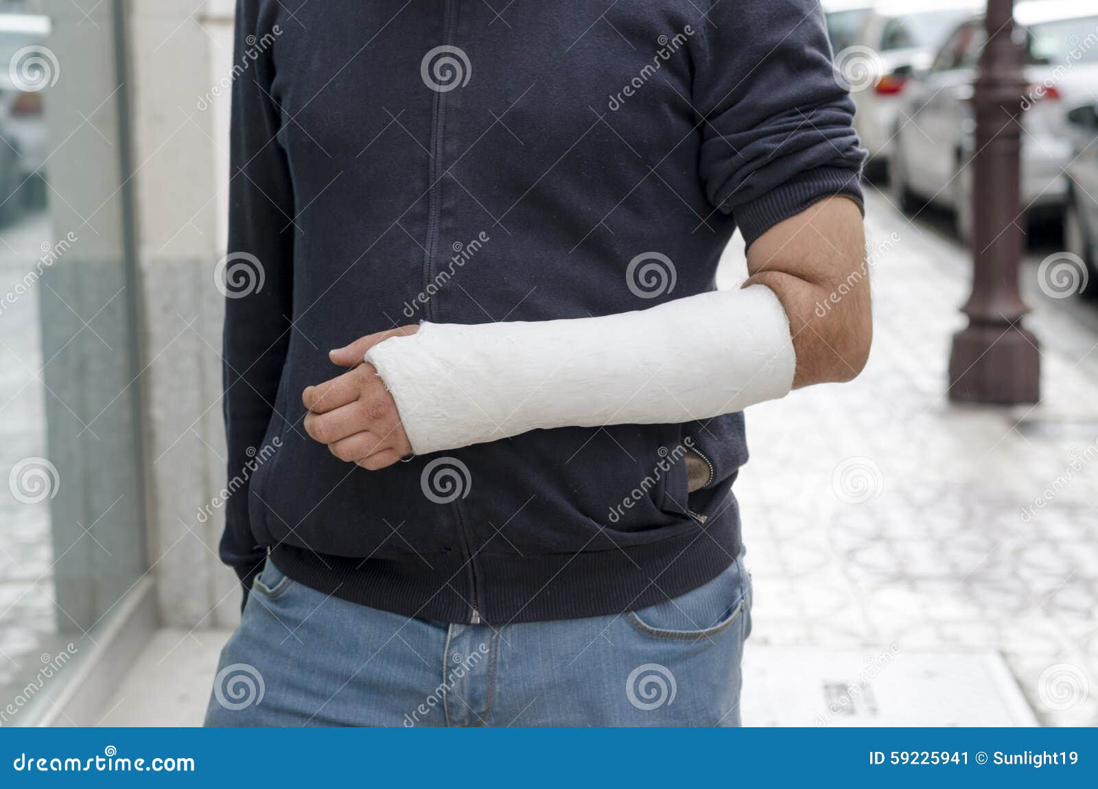 man with his broken arm. arm in cast.