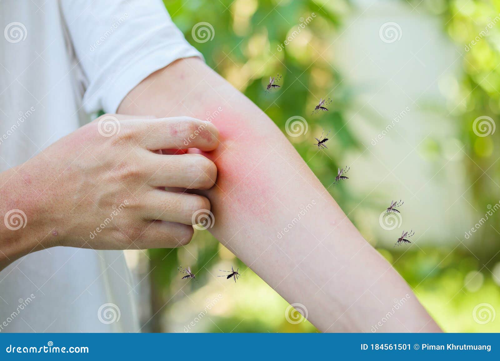 Man Itching And Scratching On Arm From Allergy Skin Rash Cause By