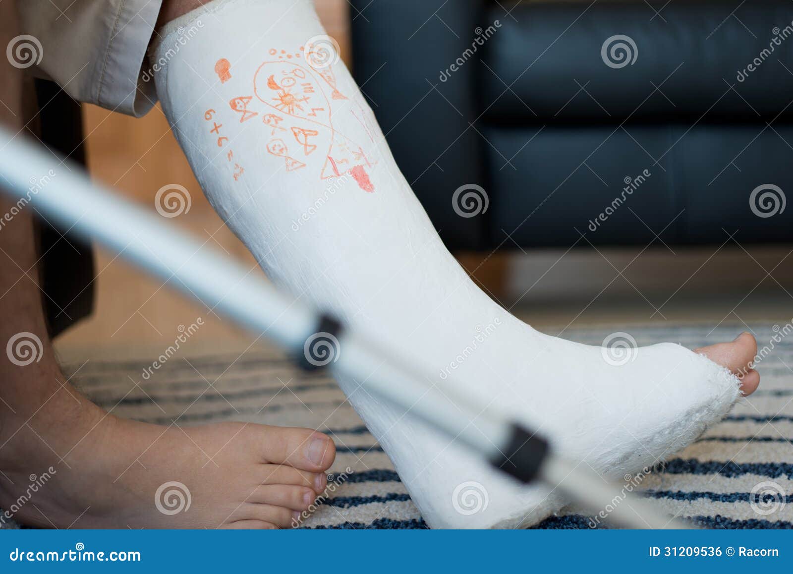 Plaster Paris Cast Stock Photos - Free & Royalty-Free Stock Photos from  Dreamstime