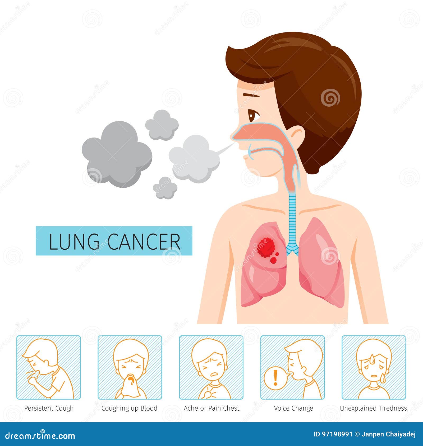 Man With Lung Cancer Diagram And Symptoms Icons Stock