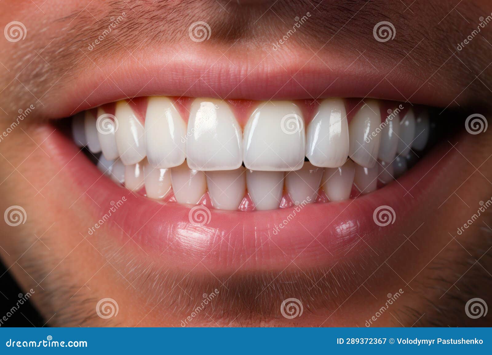 Man with Missing Tooth and Missing Teeth is Smiling. Generative AI