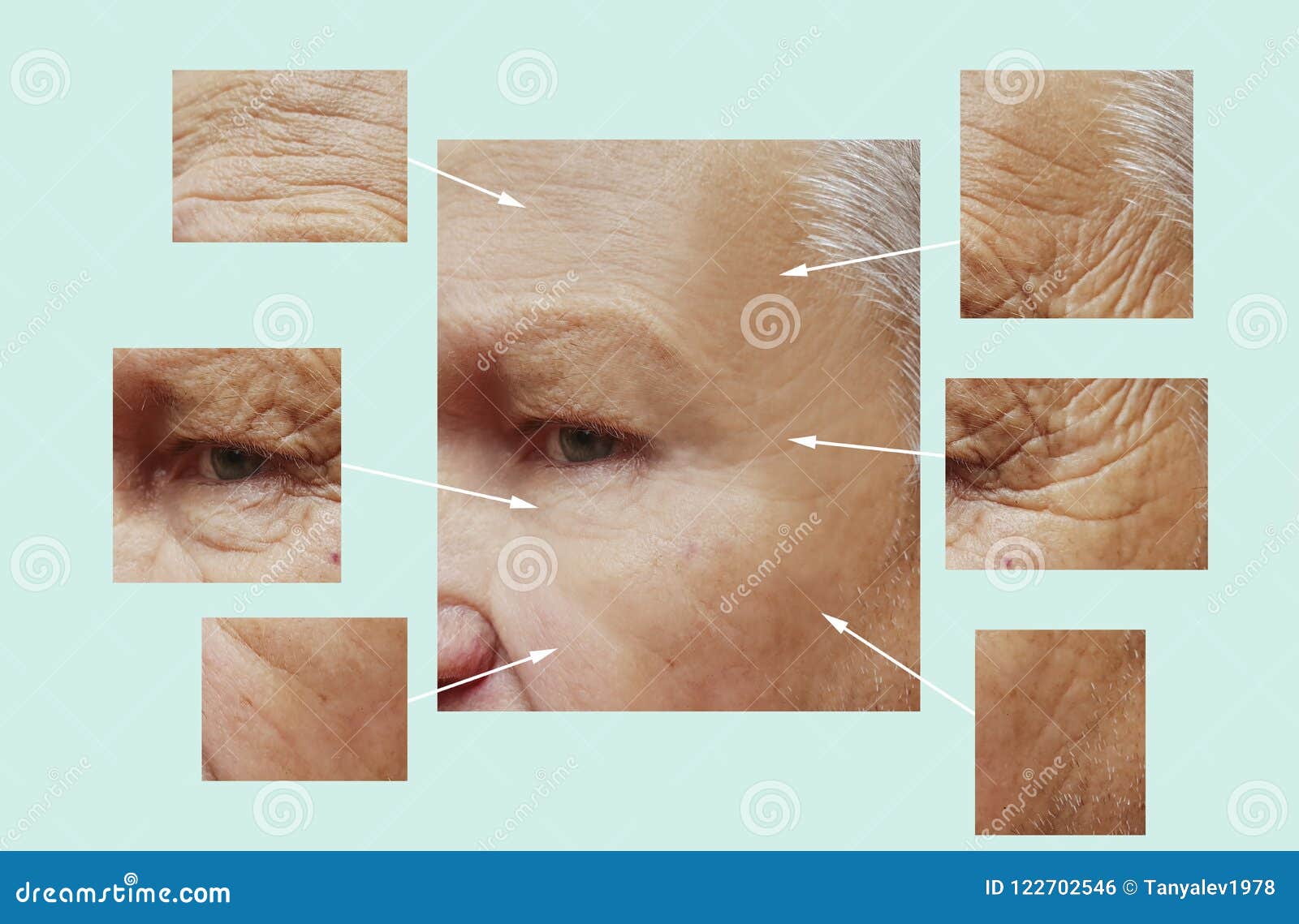 man of old wrinkles on face before after therapy dermatology medicine filler collagen hydrating removal, aging procedures