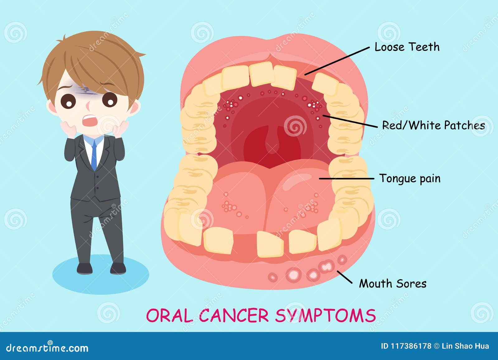 man with oral cancer symptoms