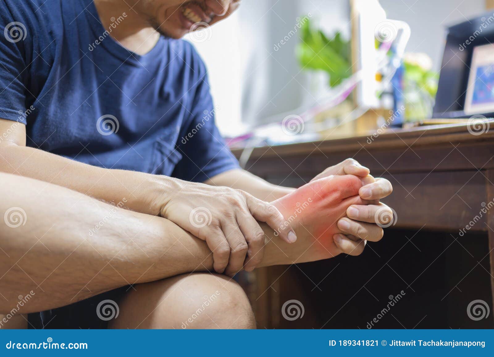 man with painful and inflamed gout