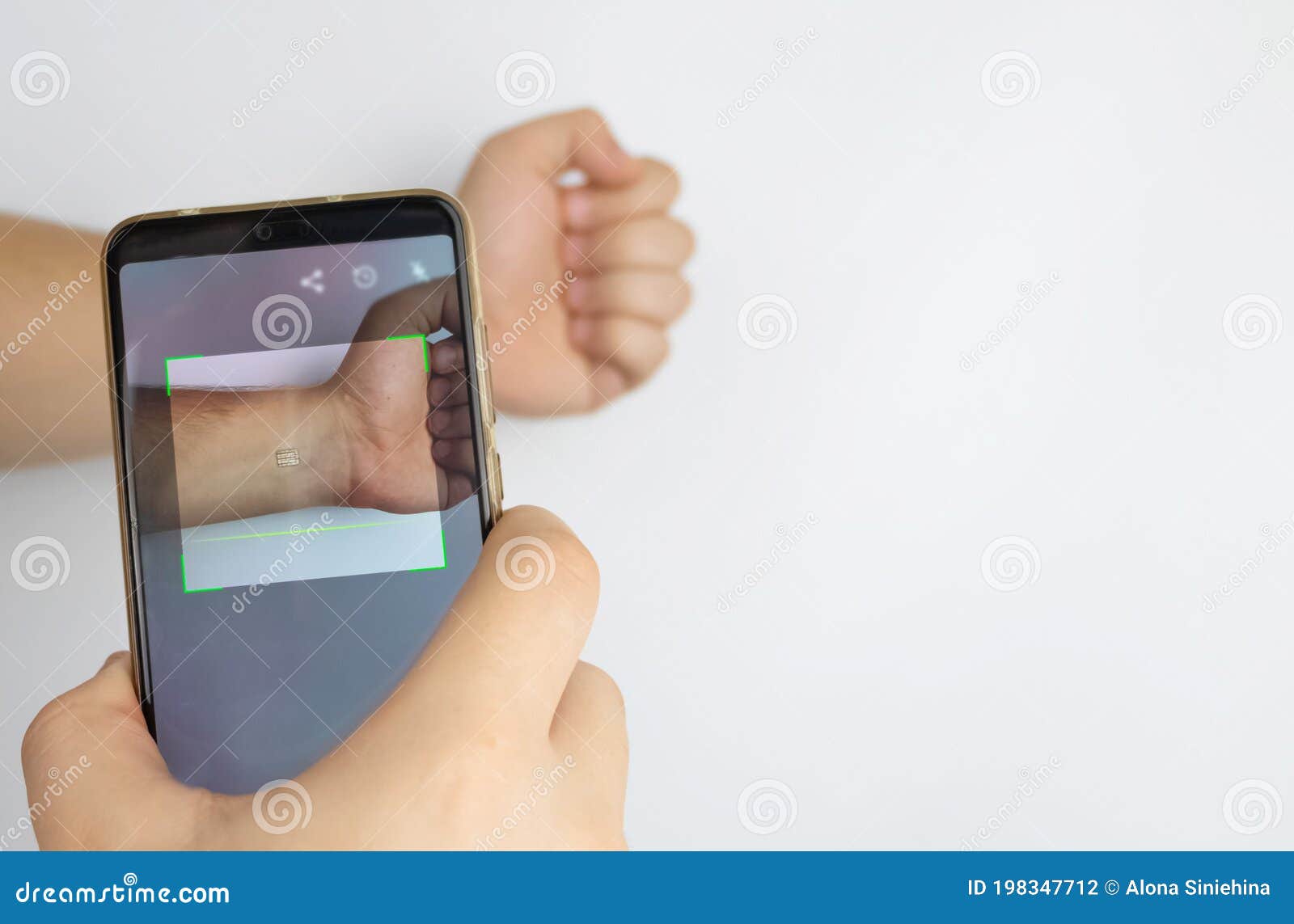 Human Chipping Concept, RFID Tags. A Male Hand With An Implantable Chip