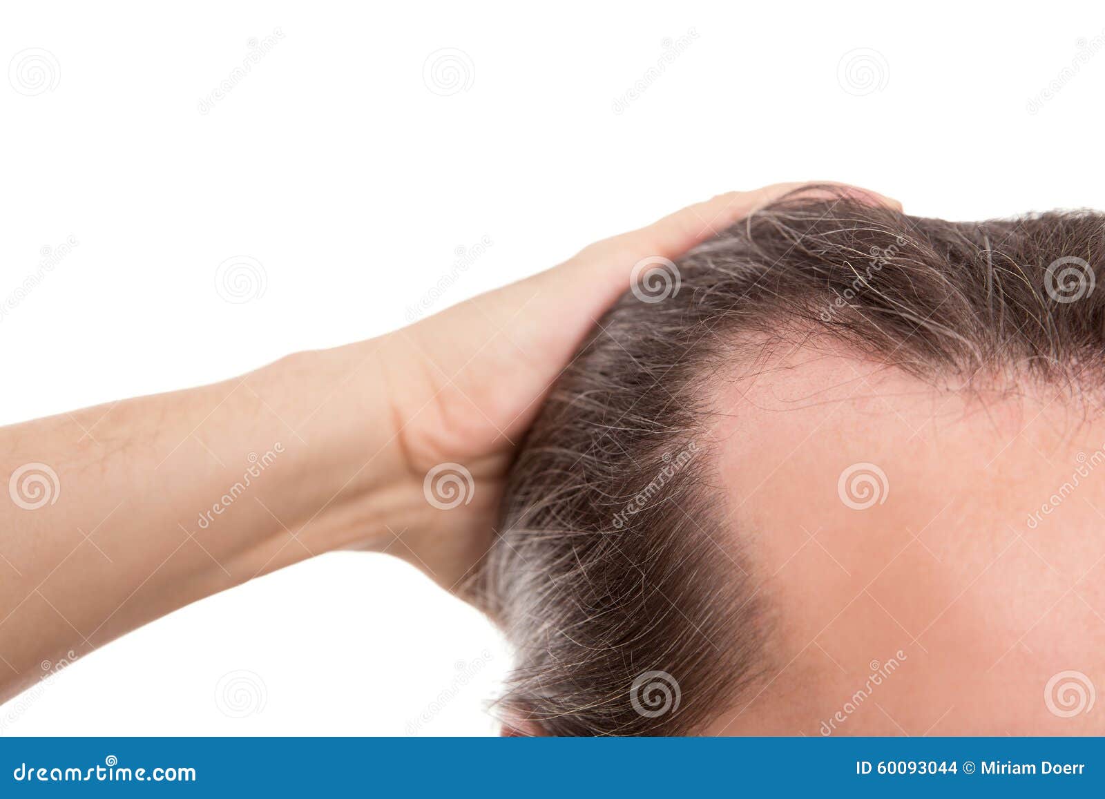 man with receding hairline, closeup  on white, concept a