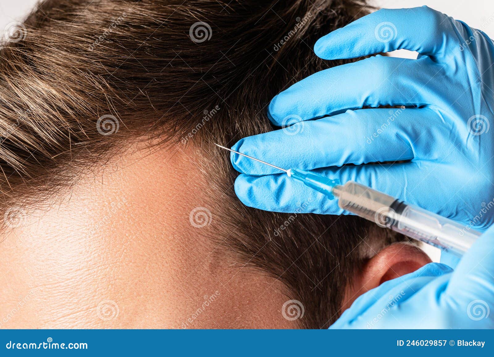 man receiving scalp injection for hair grow