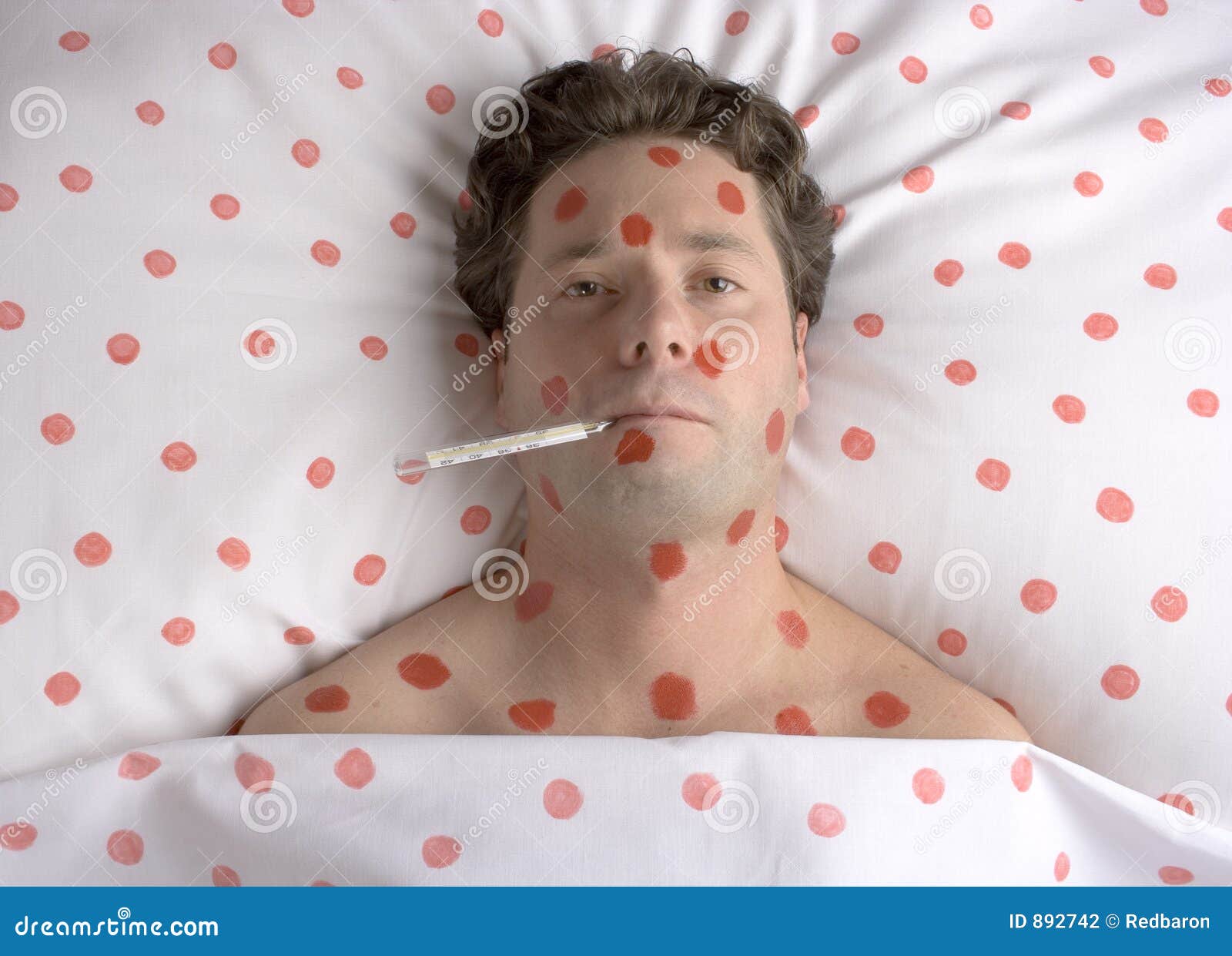 Man with Red Spots on Face and Body Stock Photo Image of suffering