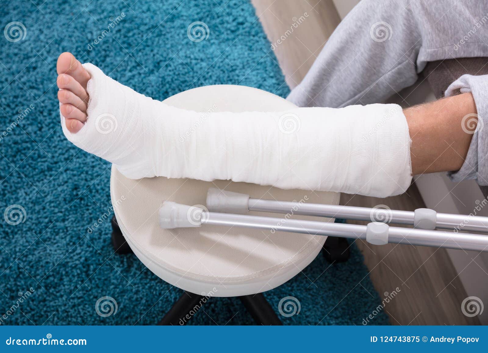 man`s broken leg