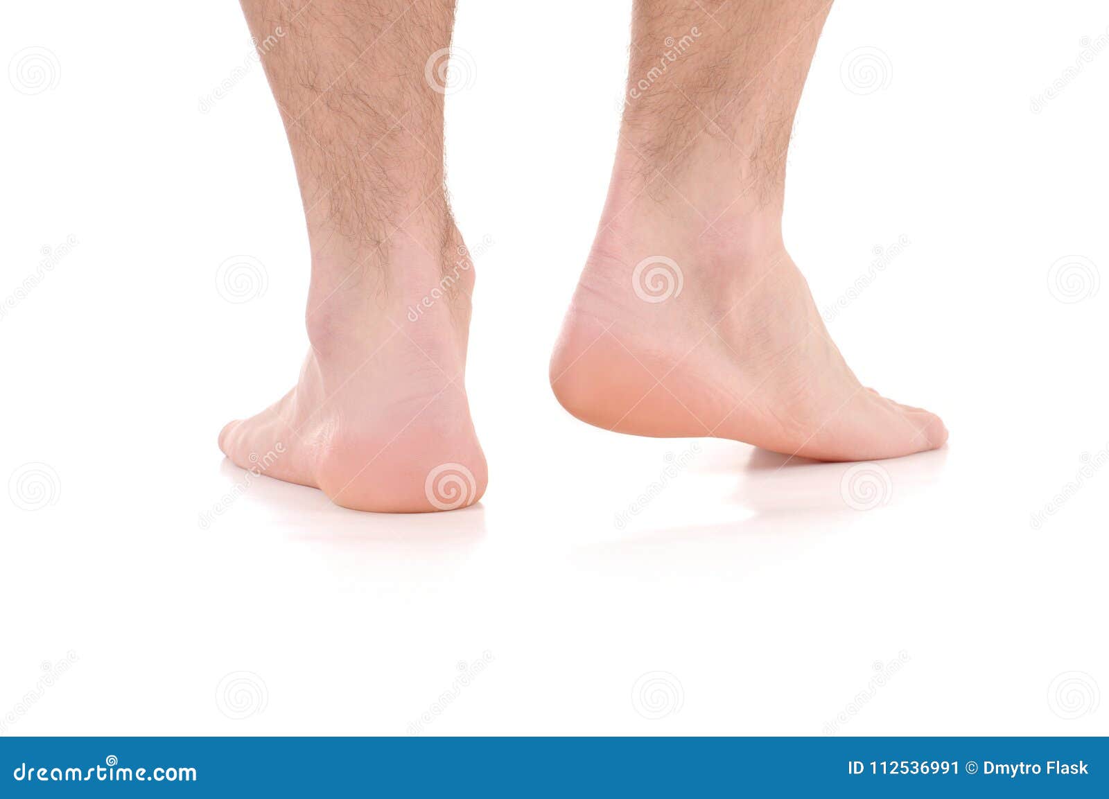 Man`s Feet. Care for Feet and Heels. Stock Image Image of dermatitis, care 112536991