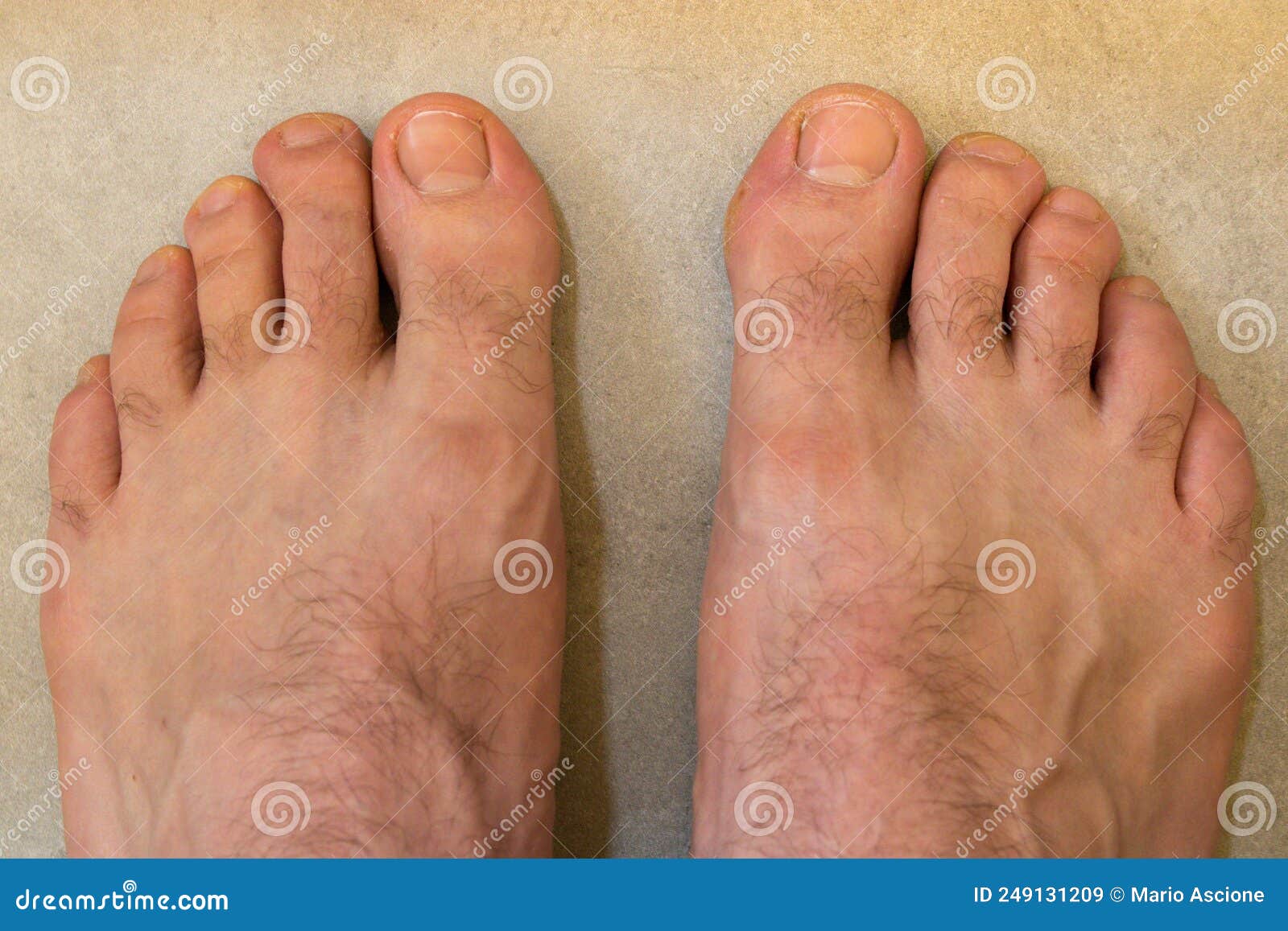 man`s feet.