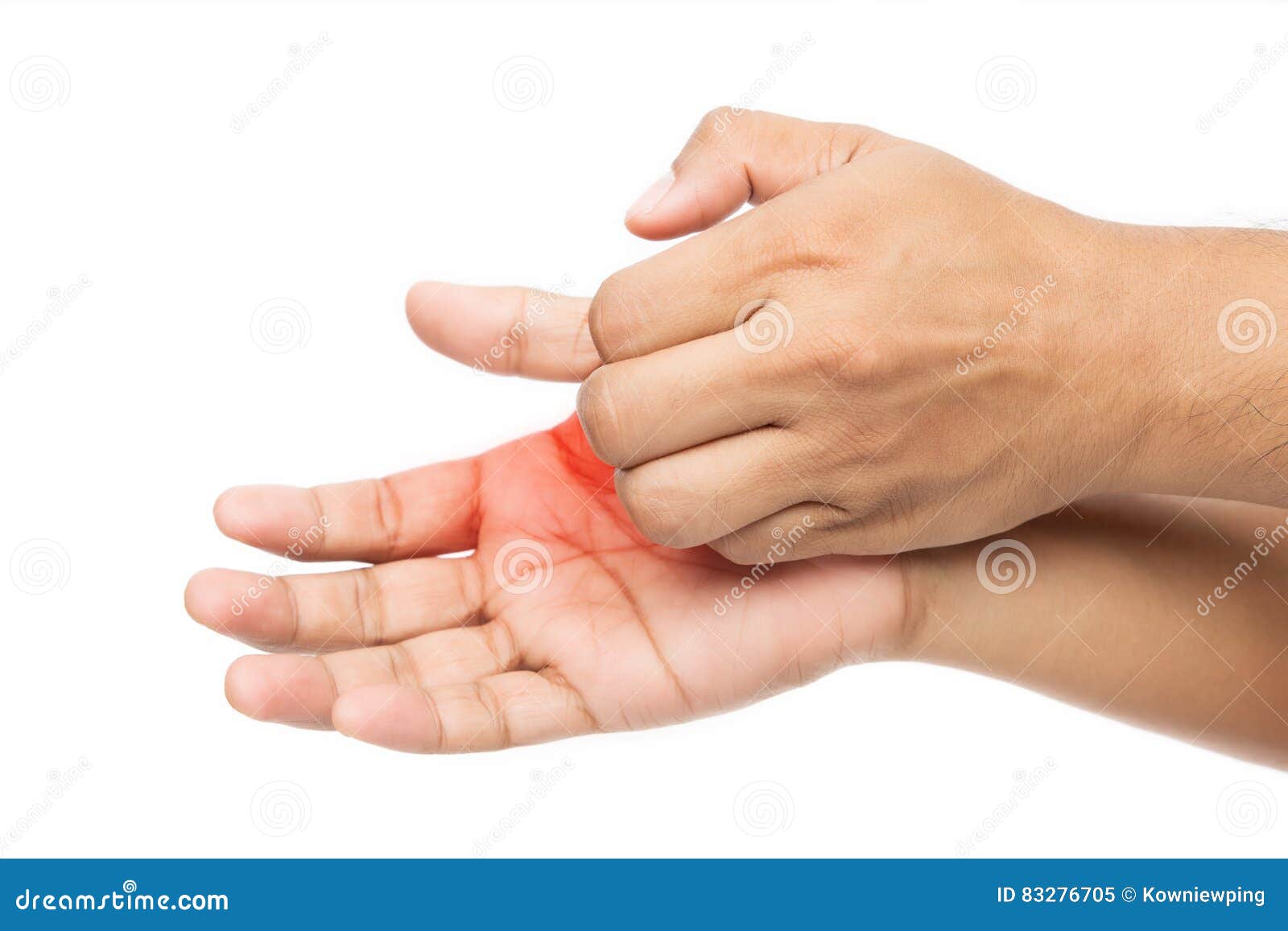 People Scratch The Itch With Hand Stock Photo 83861082