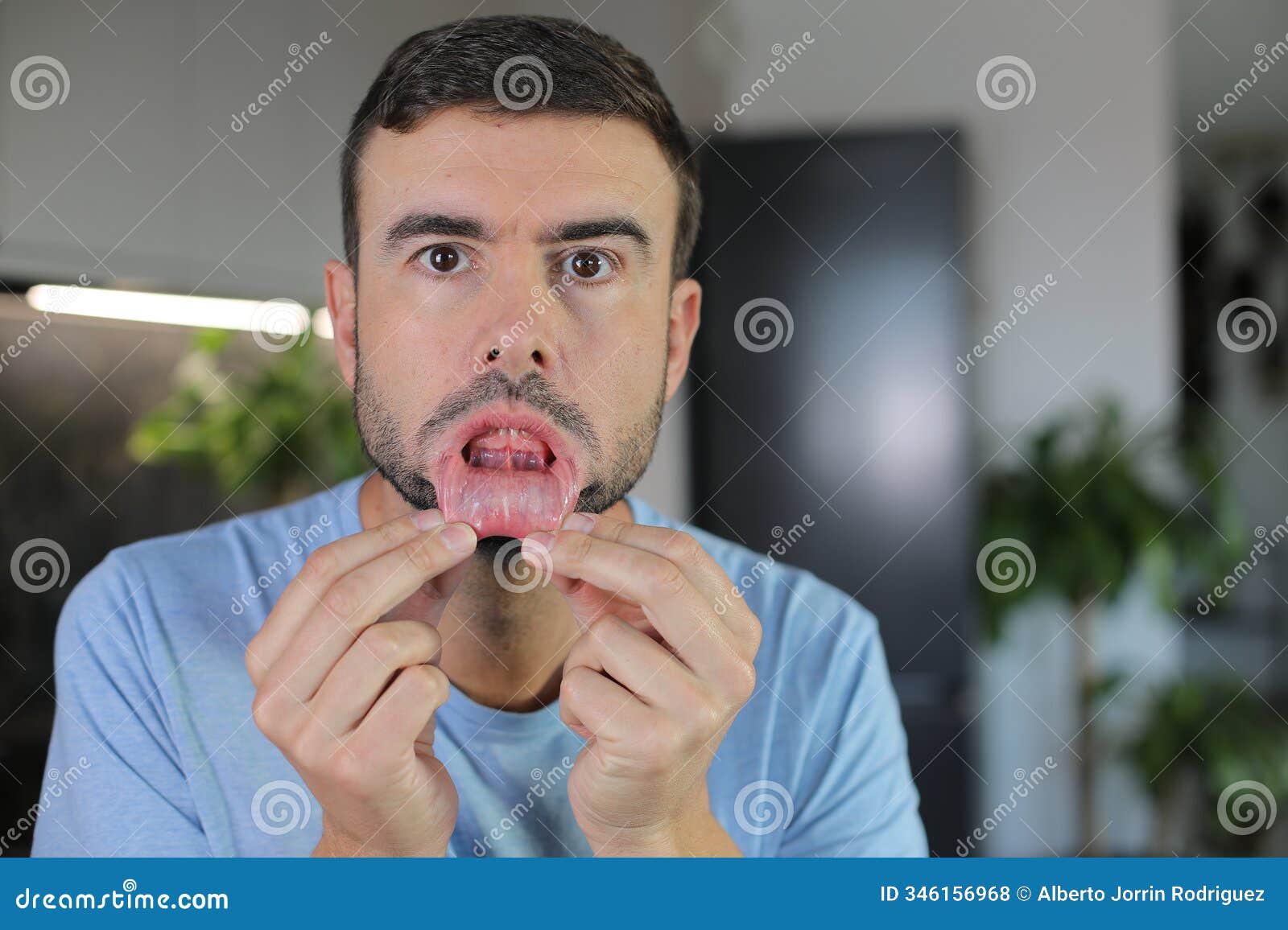 Man Showing His Oral Mucosa Stock Photo Image of dental, infection