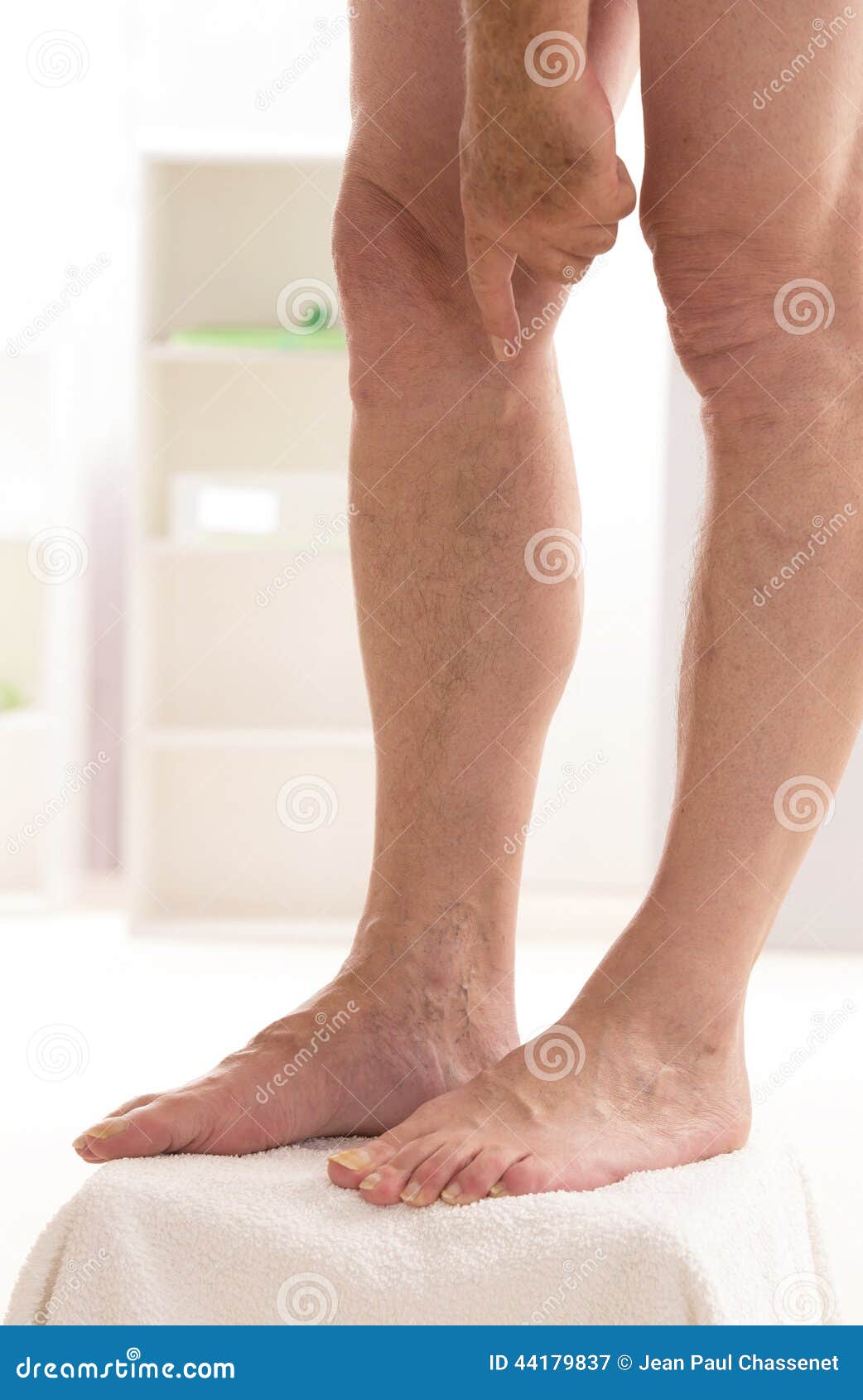 Man Showing Varicose Veins Closeup, Foot on Modular Bath Step Stock
