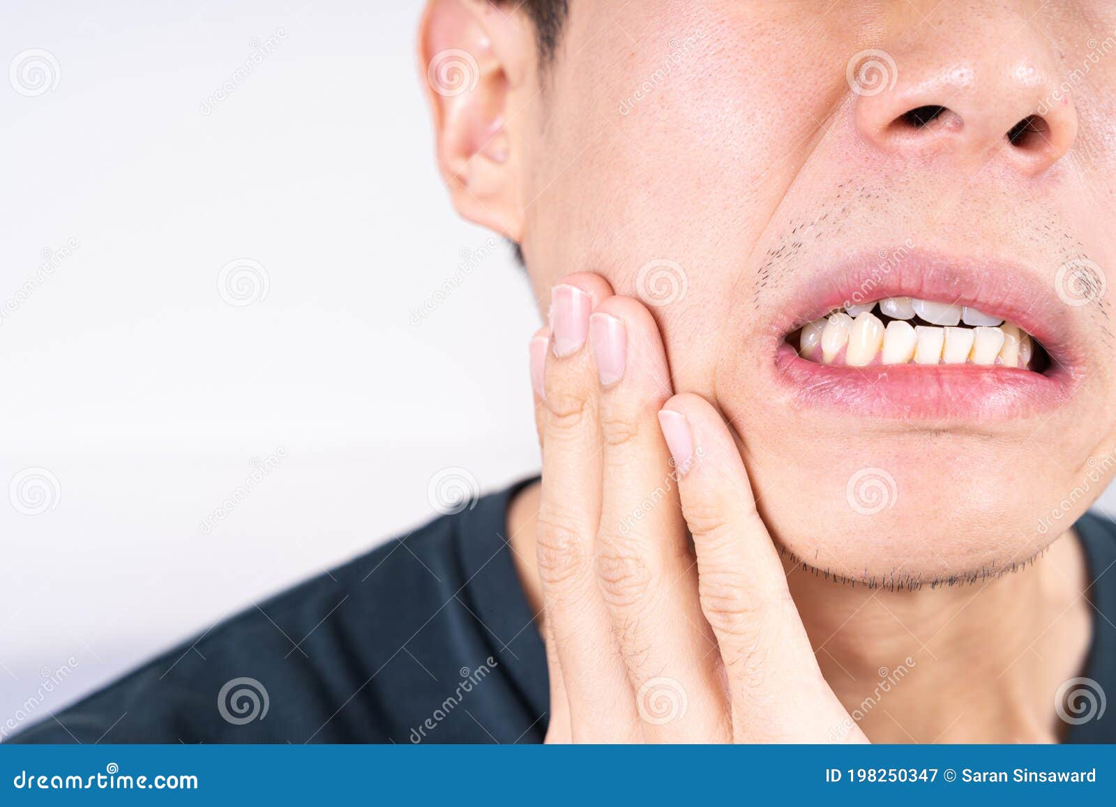 Toothache In Wisdom Teeth