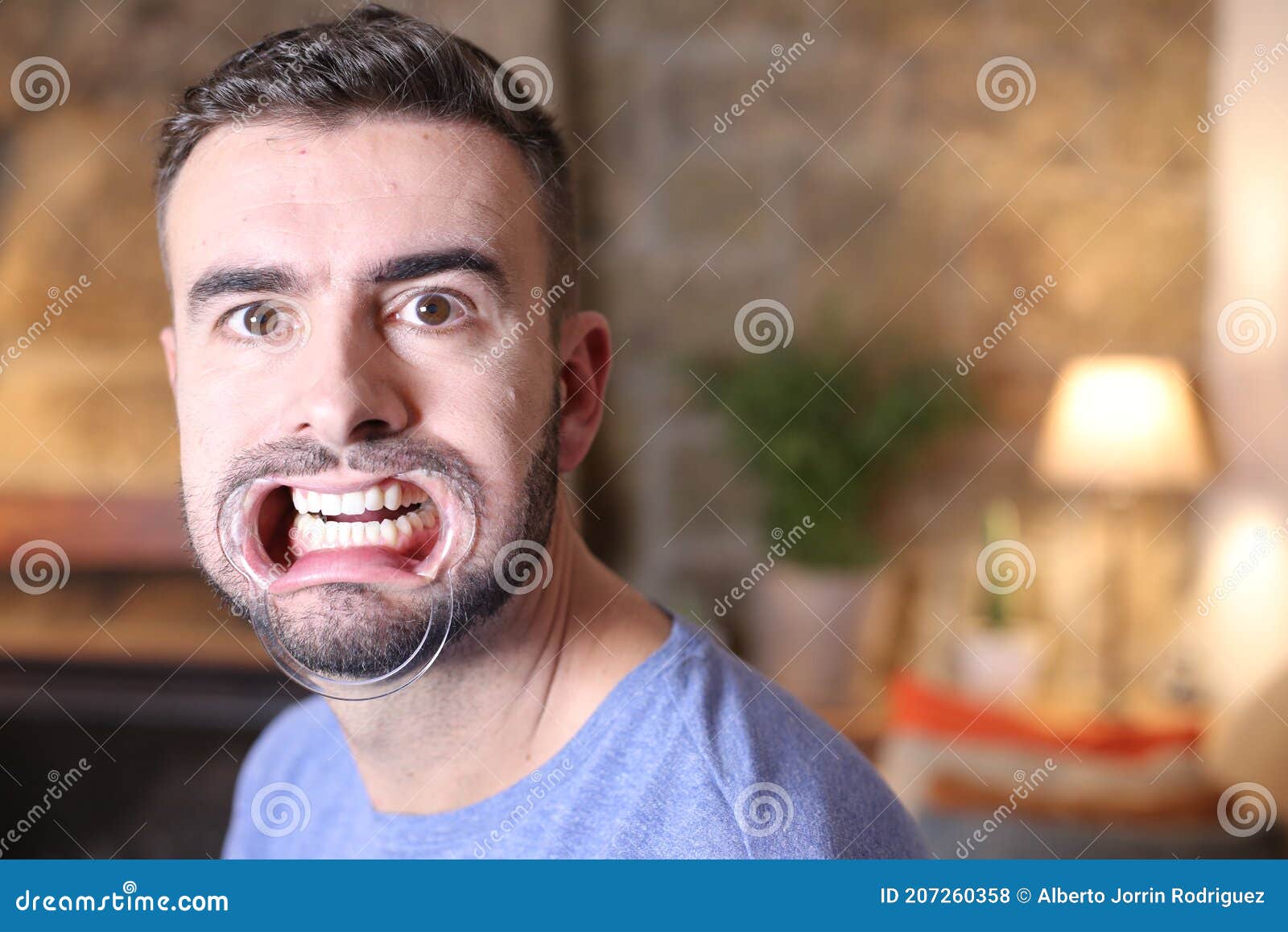 Man Using Dental Plastic Mouth Opener Stock Photo Image of dental