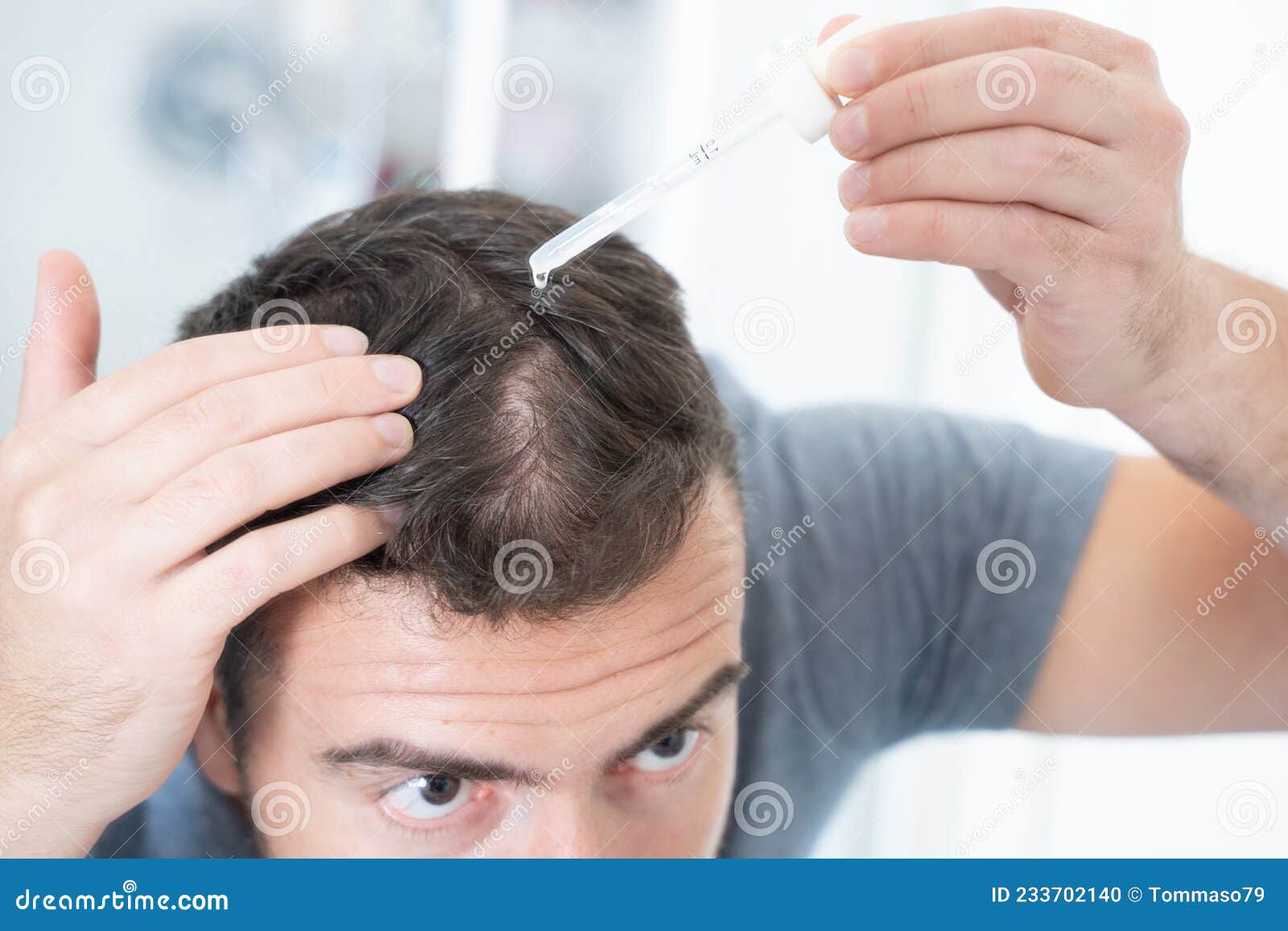 Man Using Hair Loss Treatment on His Scalp Stock Photo Image of