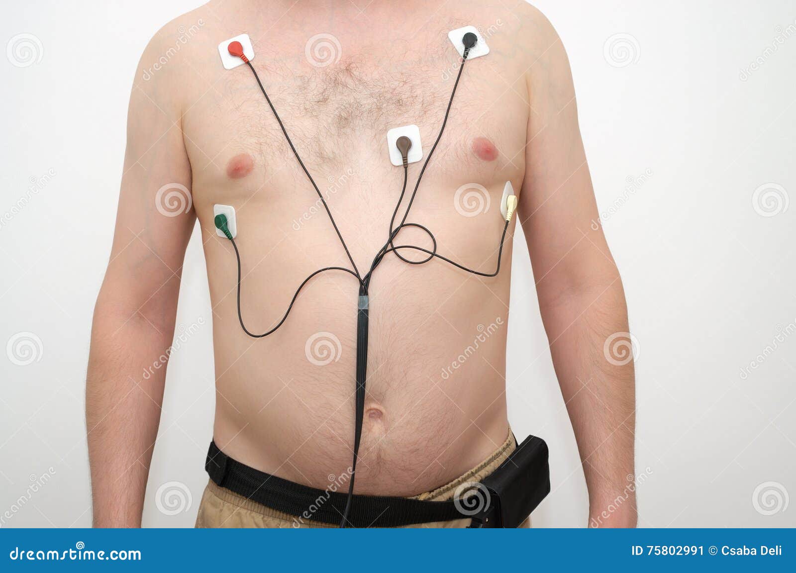 man wearing holter monitor