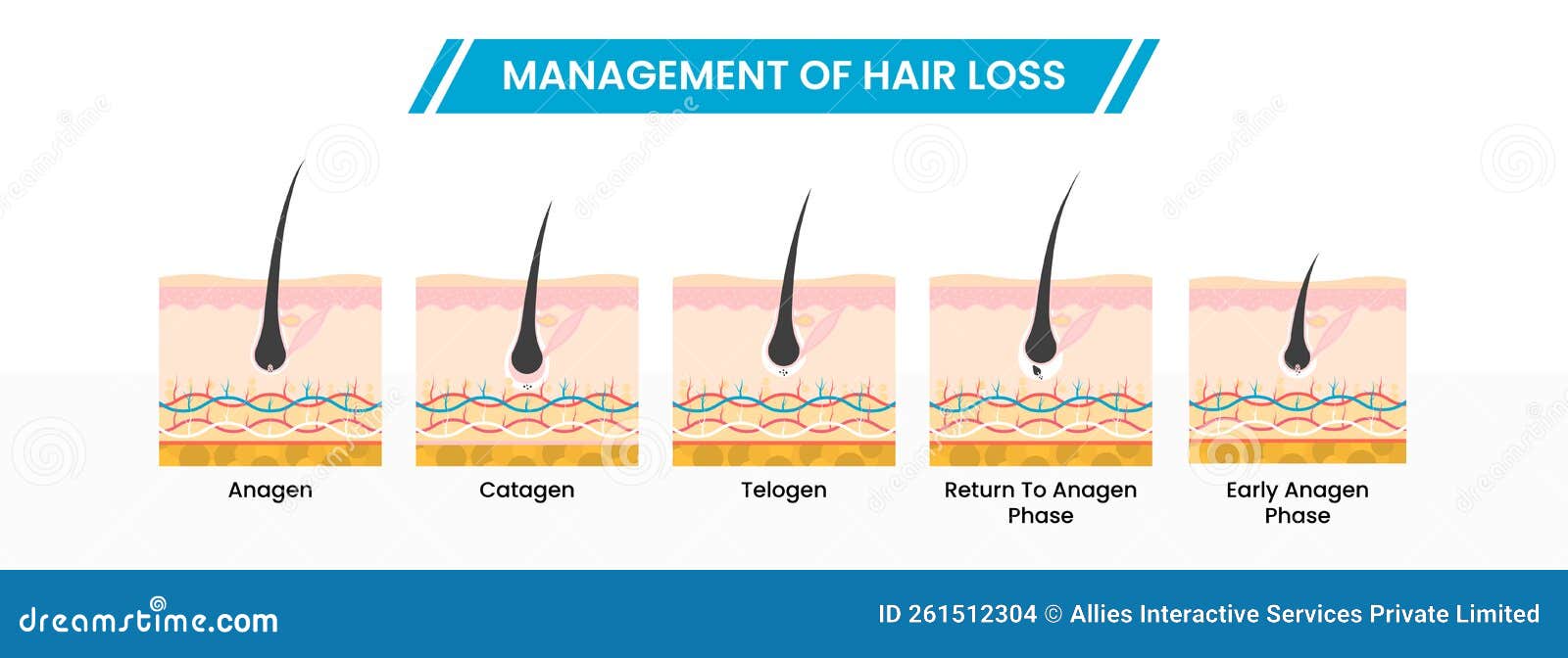 Management of Hair Loss or Growth Phases Infographic Scheme Icons in