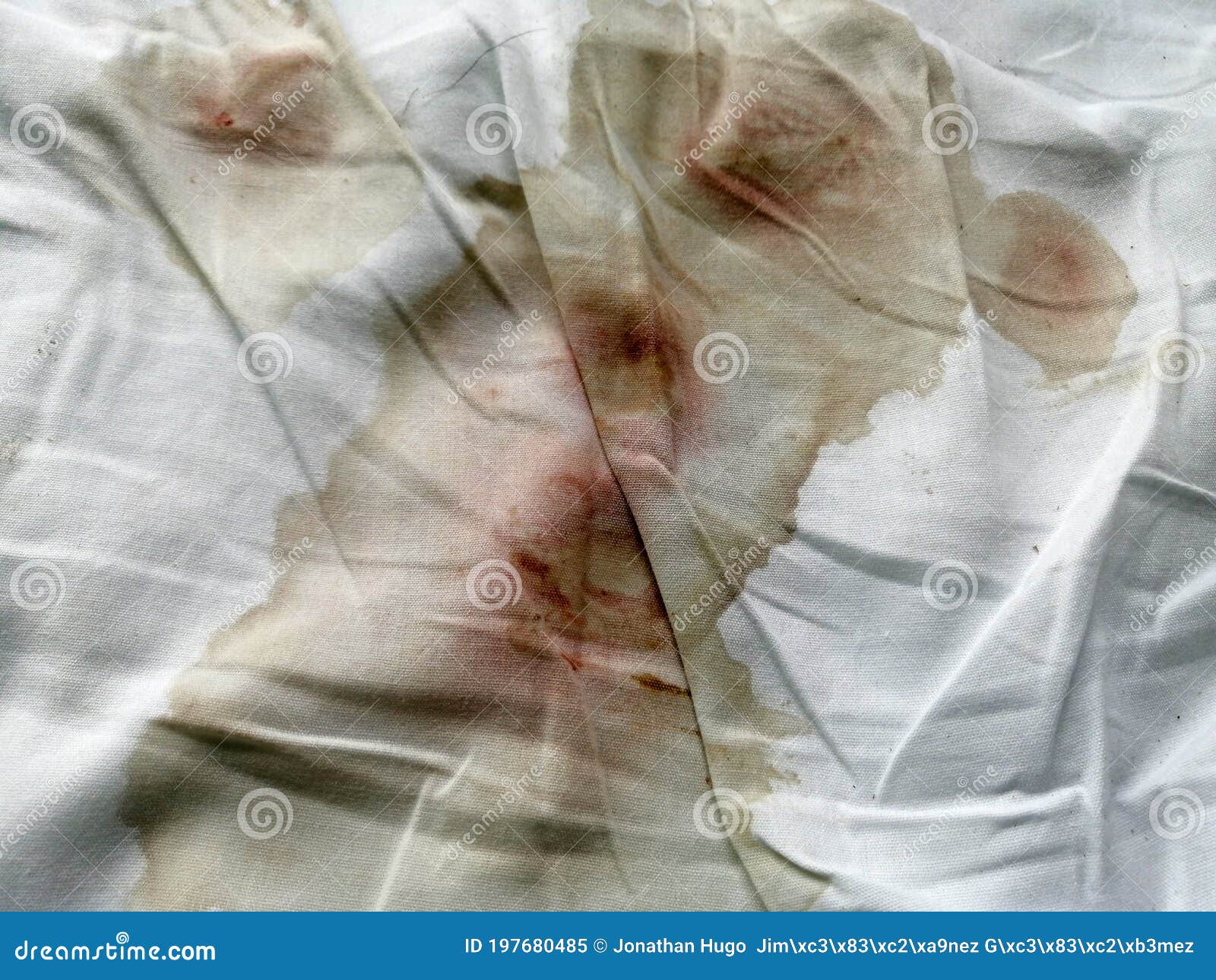 marca Pelmel Agacharse Manchas De Sangre De Ooze Frescas Sobre Sábanas Del Hospital Imagen de  archivo - Imagen de exude, paciente: 197680485