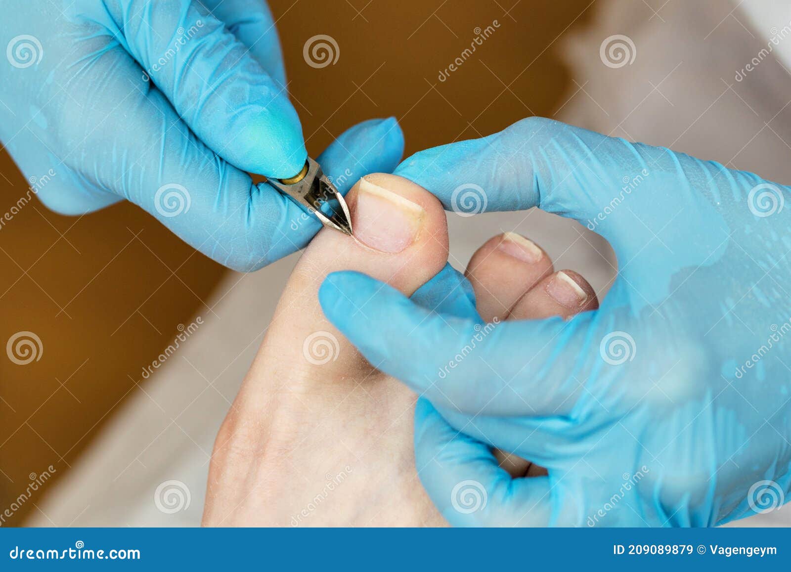 master chiropody removes cuticle