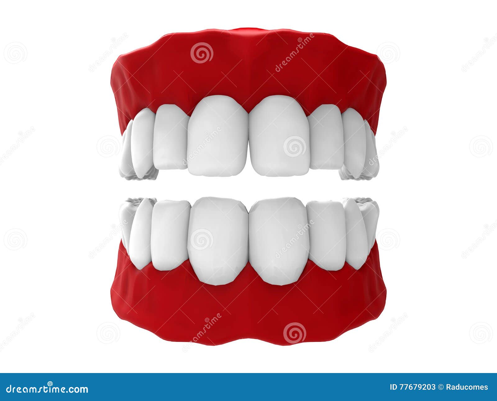 maxillary dentition 