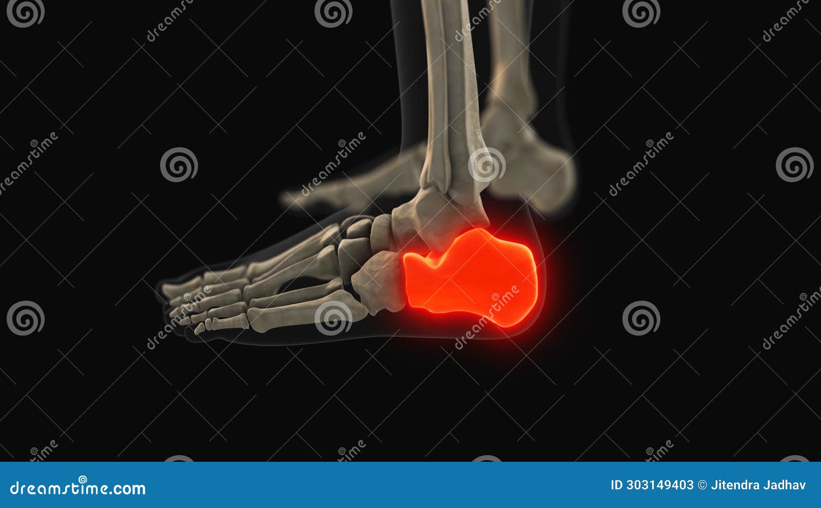 Medical Animation of the Calcaneus Bone Pain Stock Image Image of