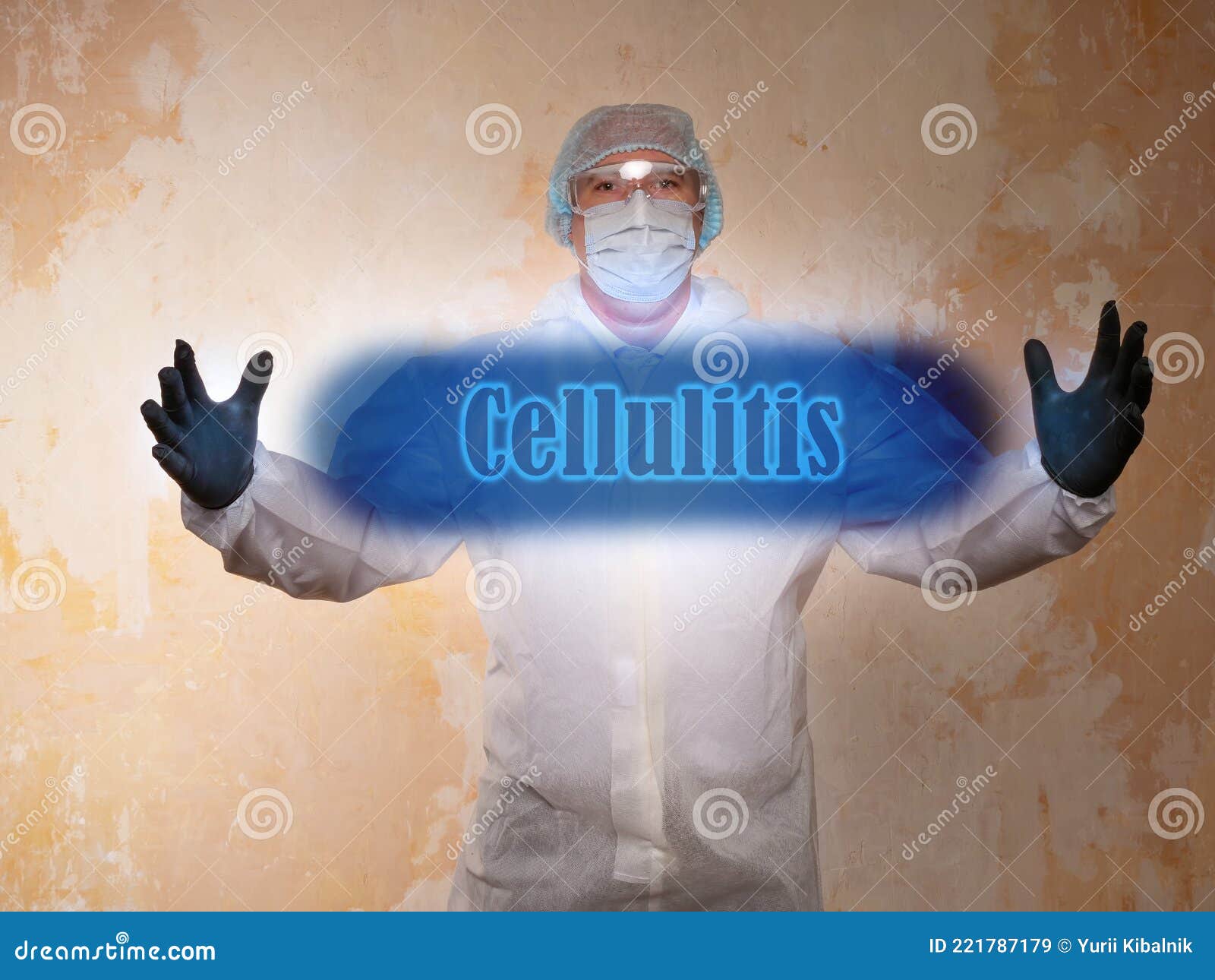 medical concept meaning cellulitis with sign on the sheet