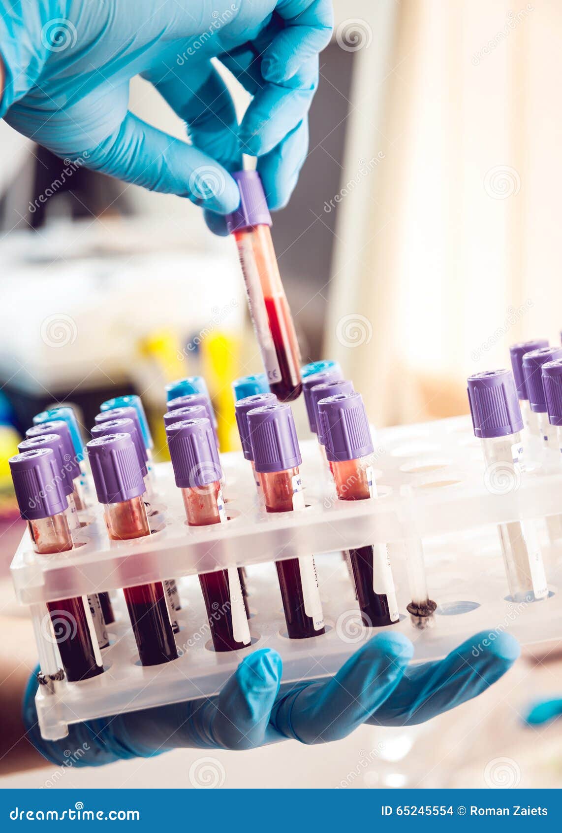 Medical equipment stock photo. Image of diagnostic, medical 65245554