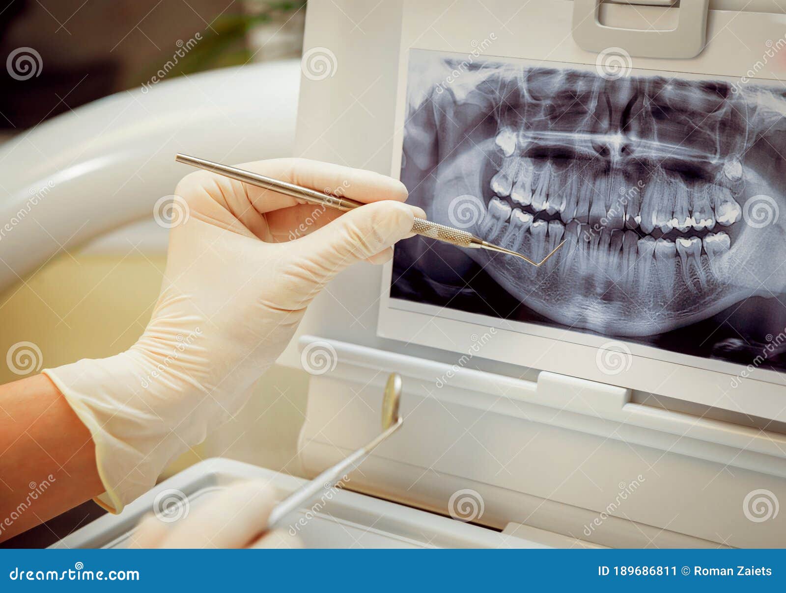 Medical Equipment in the Hands. Dental Office. Stock Image Image of