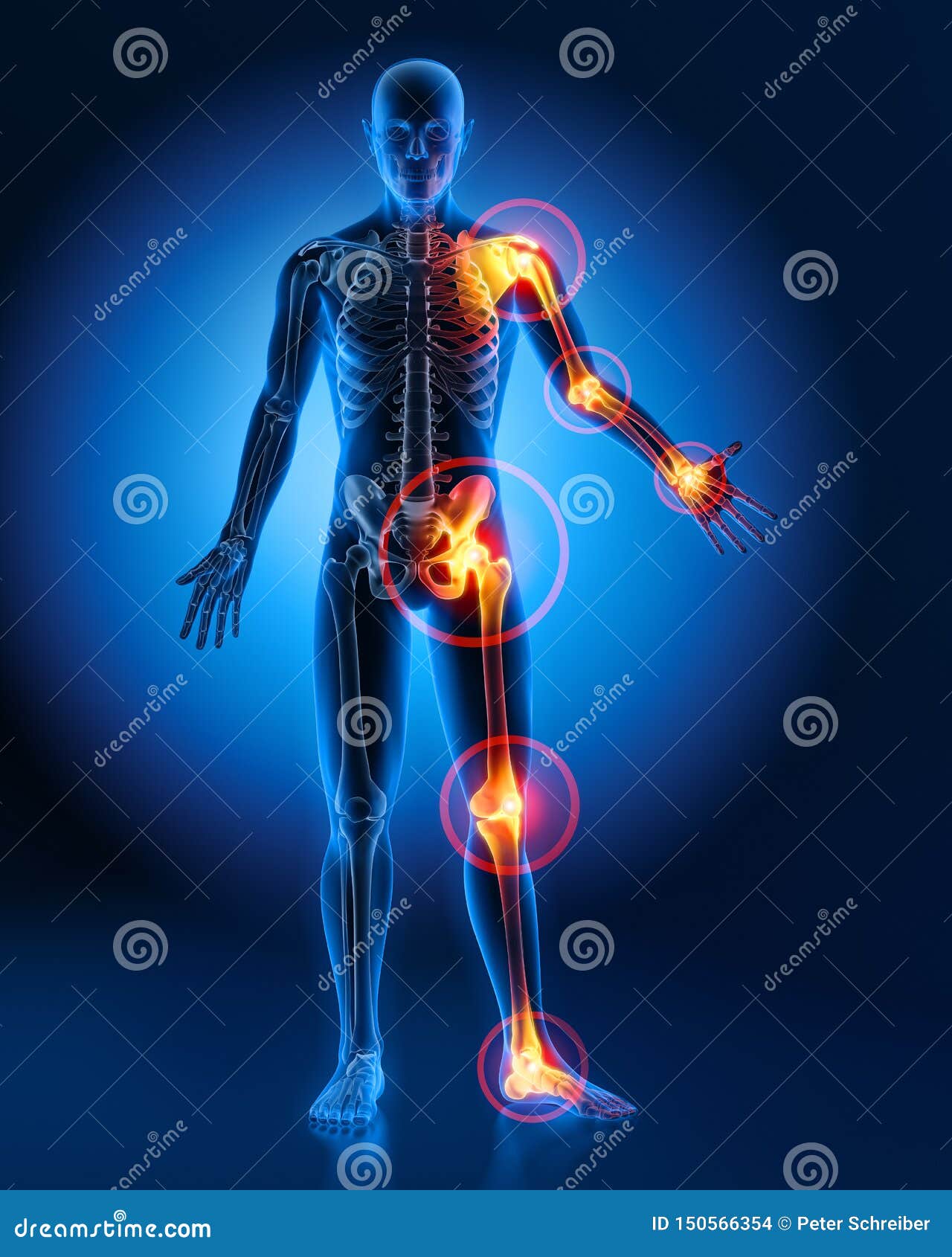 man with heavy joint pain symptoms