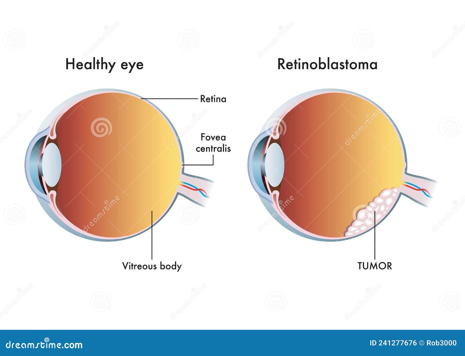 Eye Anatomy, Retina Specialists Orlando