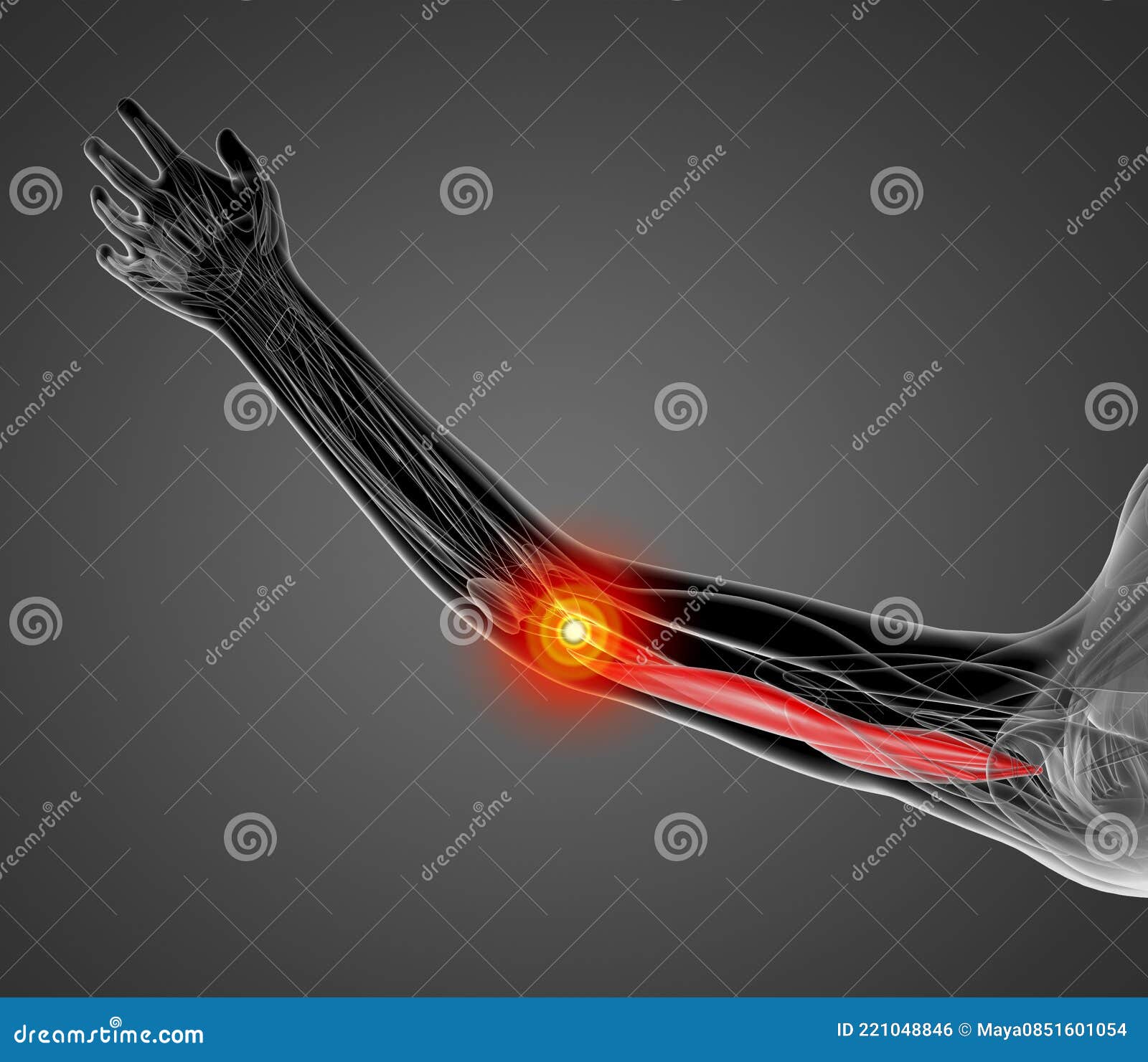 Medical Illustration of the Triceps Brachii Stock Illustration