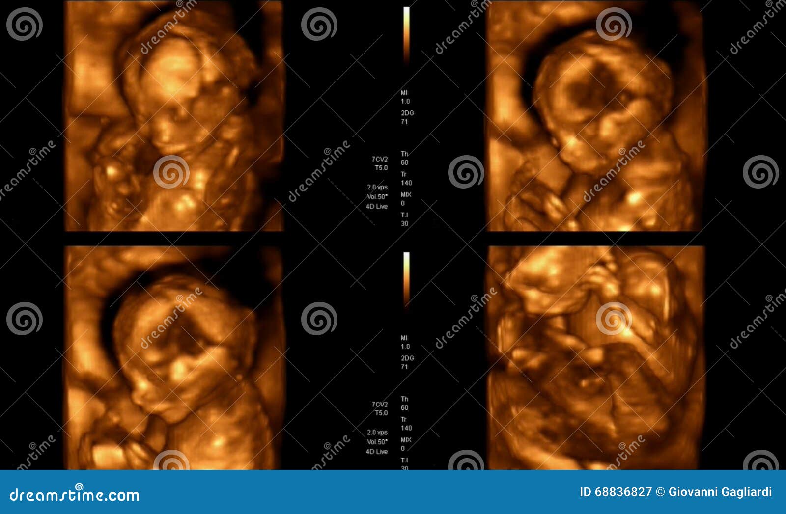 medical images collage of 4d ultrasound during woman pregnancy s
