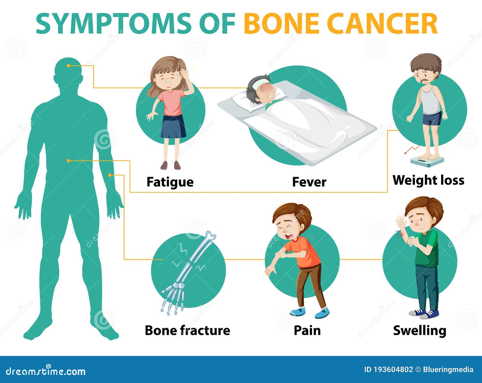 Medical Infographic of Bone Cancer Symptoms Stock Vector - Illustration