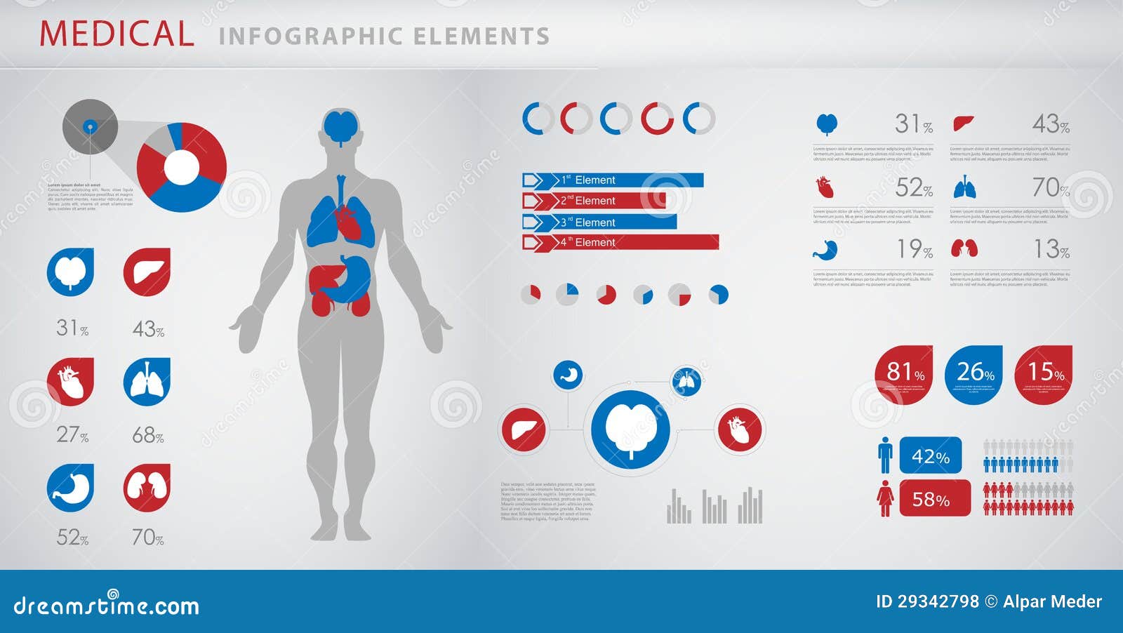 Medical Infographic Cross Section Of Female Breast With Abscess