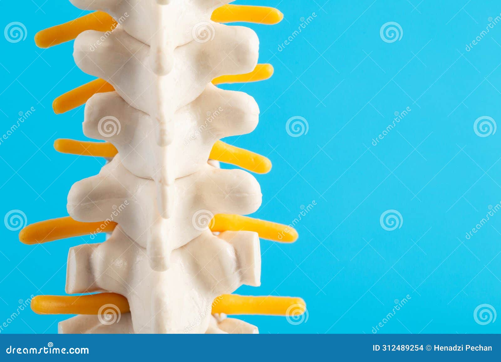 medical mockup of the thoracic spine on a blue background. concept of thoracic diseases: osteochondrosis and