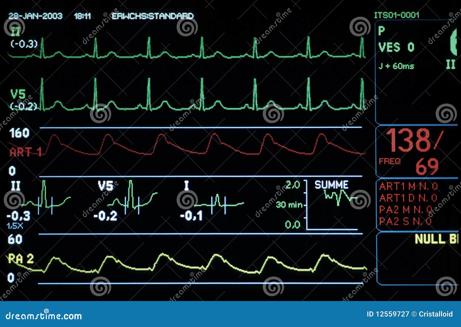 medical monitor