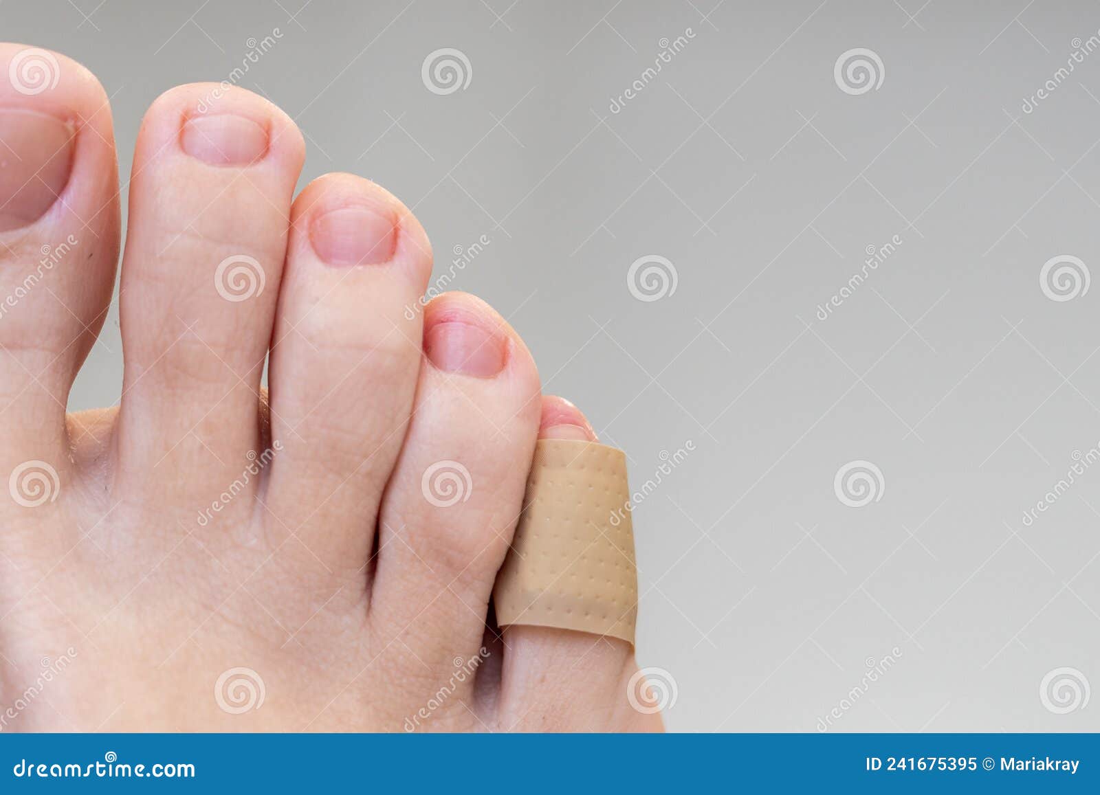Does Vicks Vaporub really cure toenail fungus? - Quora