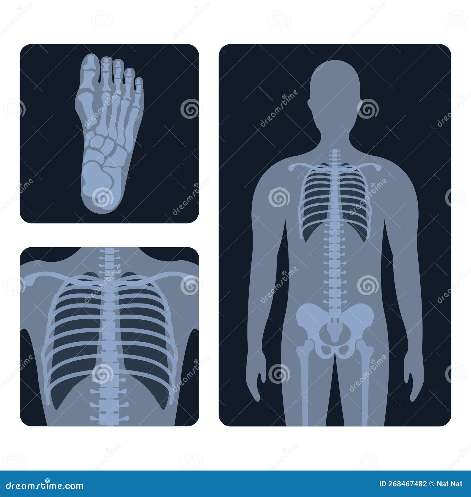 different x-ray or radiographic images of human body bones and parts