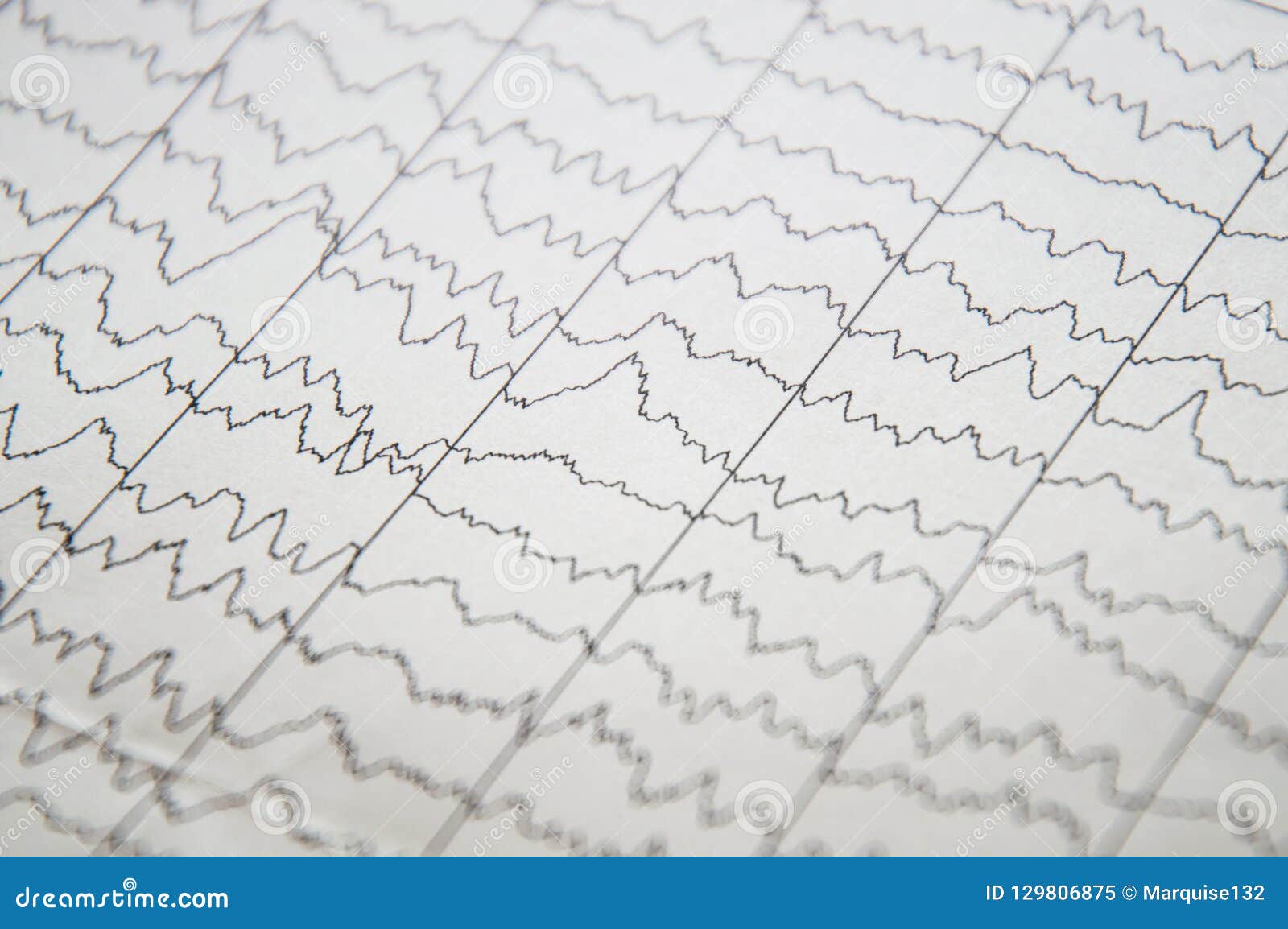 Brainwave Chart