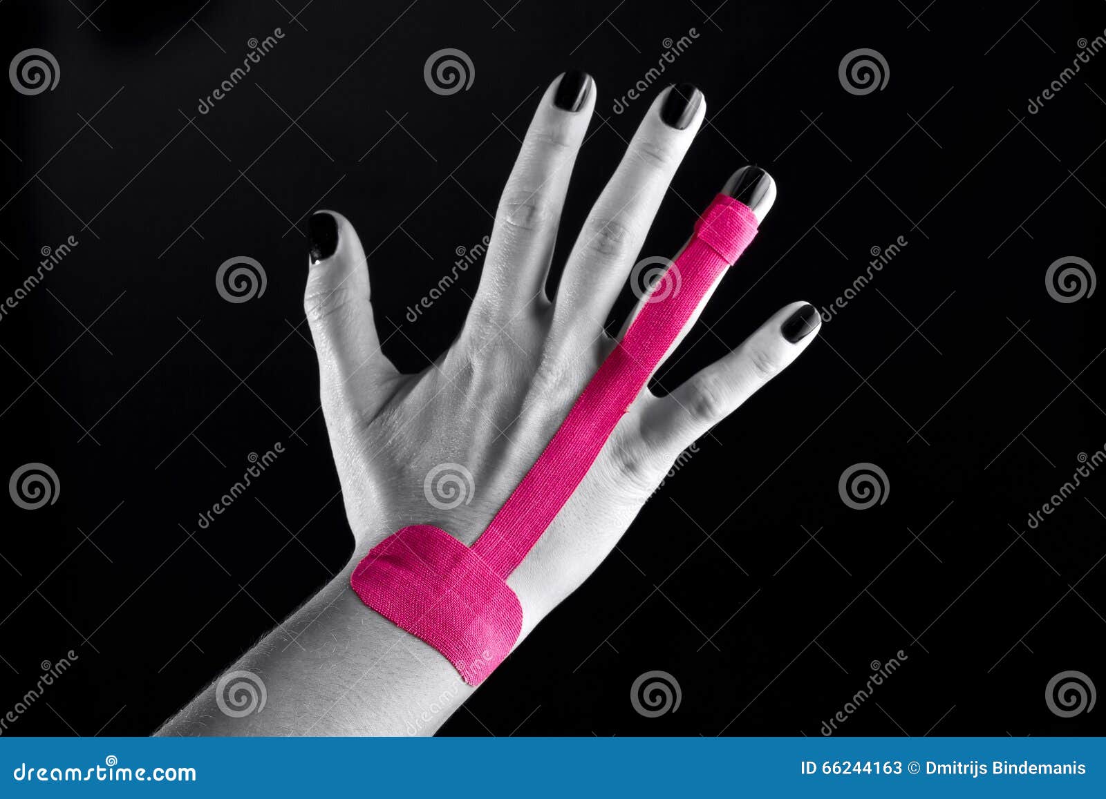 Medical taping stock image. Image of ligaments, collateral 66244163
