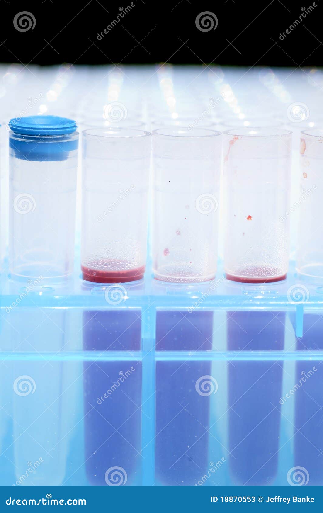 Medical test tubes stock image. Image of healthcare, biology 18870553