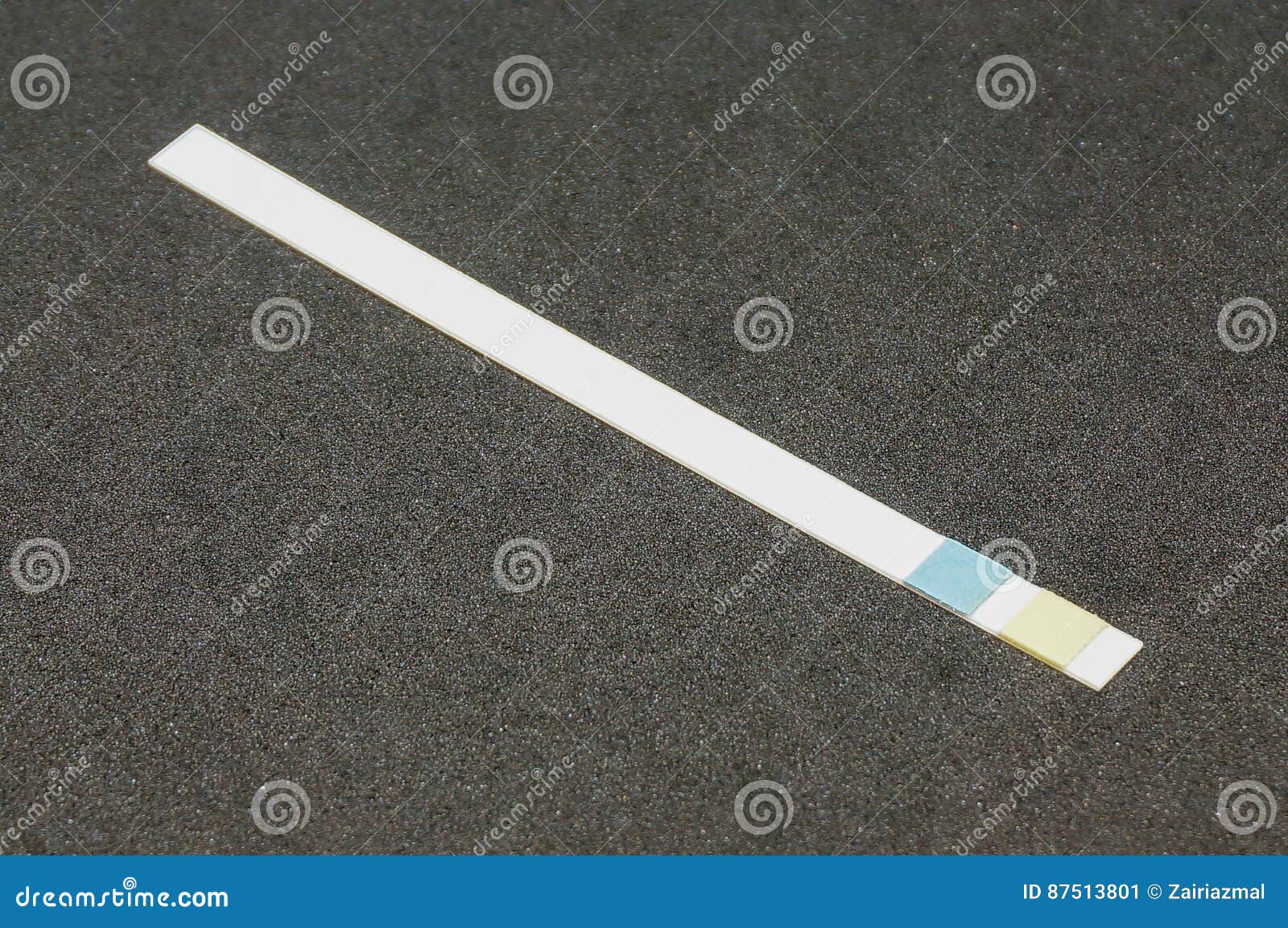 Medical urine dipstick stock image. Image of close, color 87513801