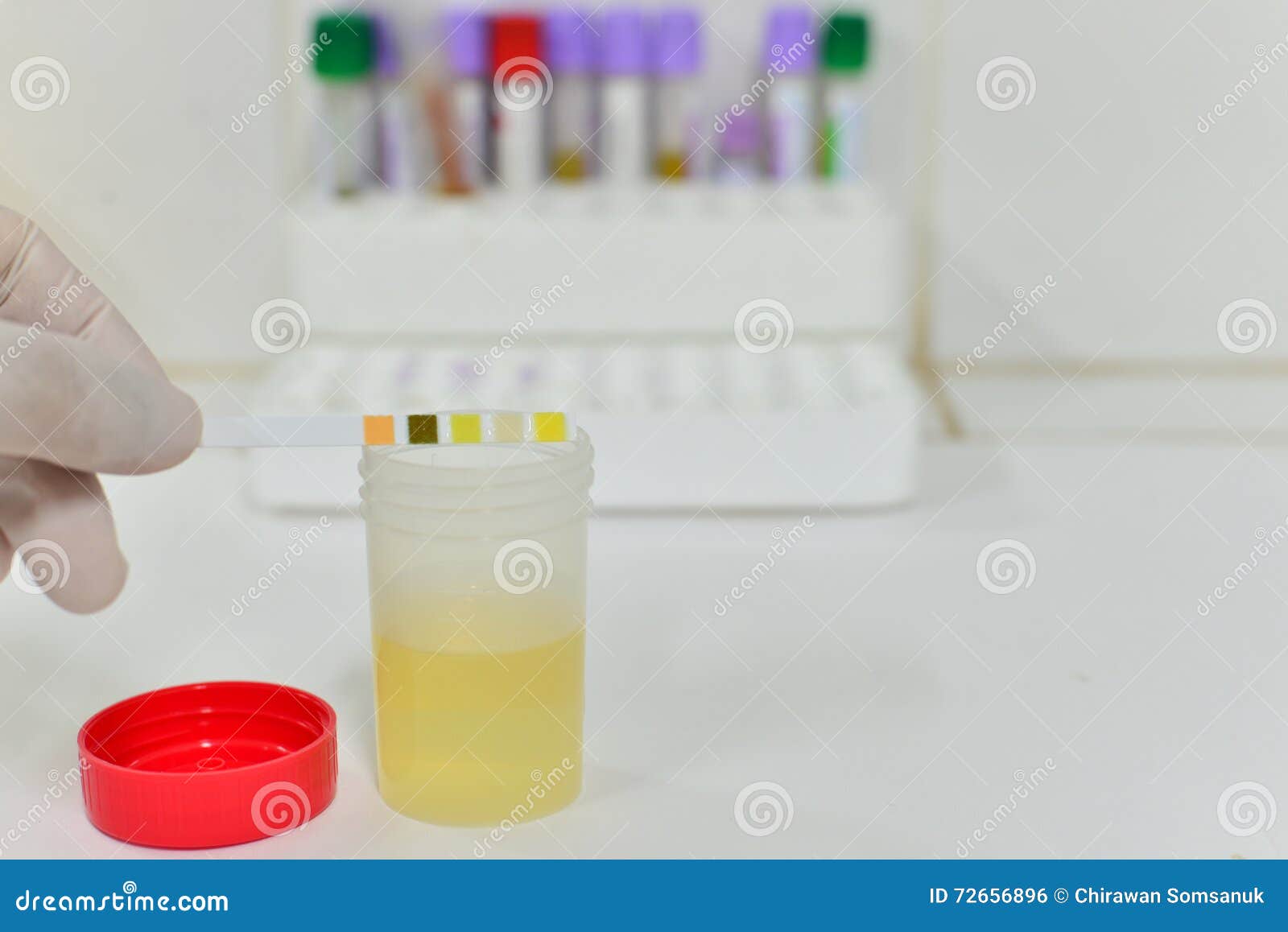 Medical Urine Test, Closeup Stock Photo Image of exam, intern 72656896