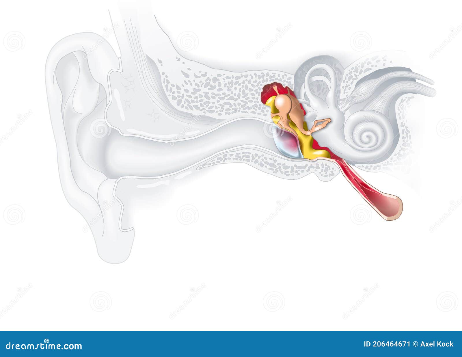 inflammation of the middle ear, otitis media, medically 