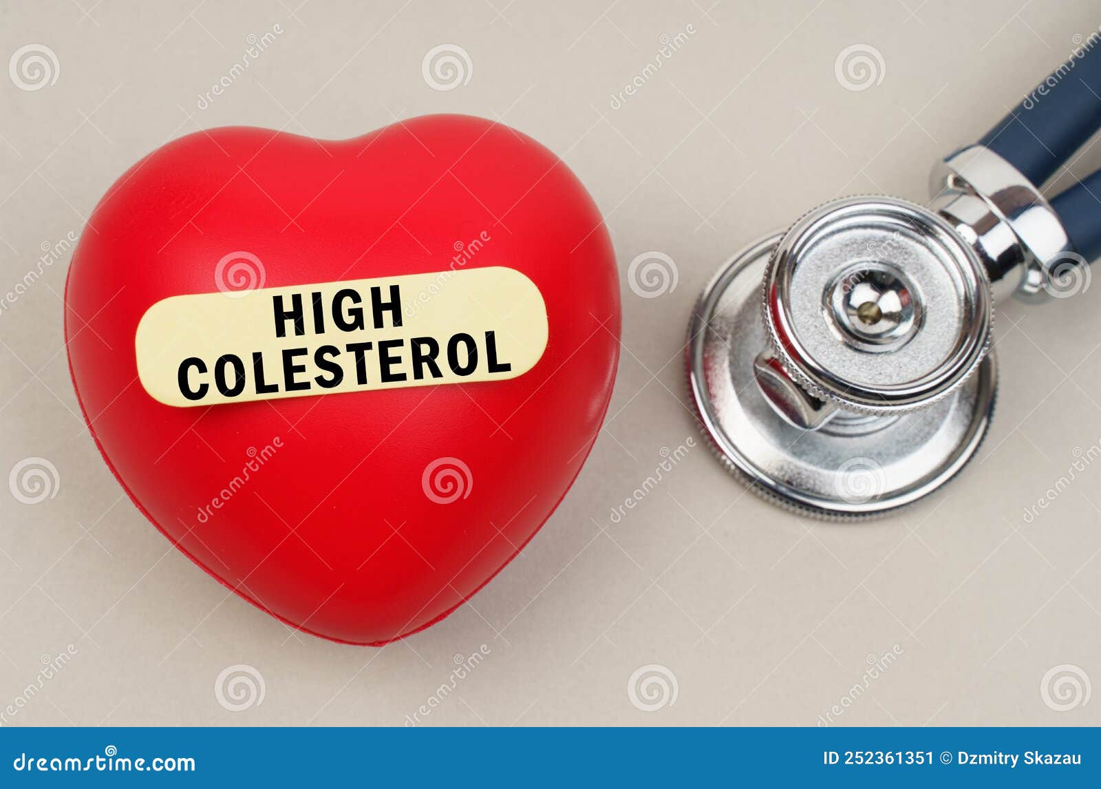 near the stethoscope lies a heart on which a sticker is pasted with the inscription - high colesterol