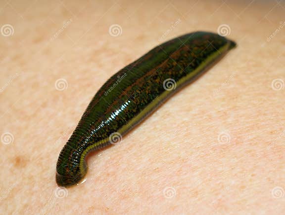 Medizinischer Blutegel Hirudo Stockfoto Bild Von Organ Ringelwurm medizinischer-blutegel-hirudo-stockfoto-bild-von-organ-ringelwurm