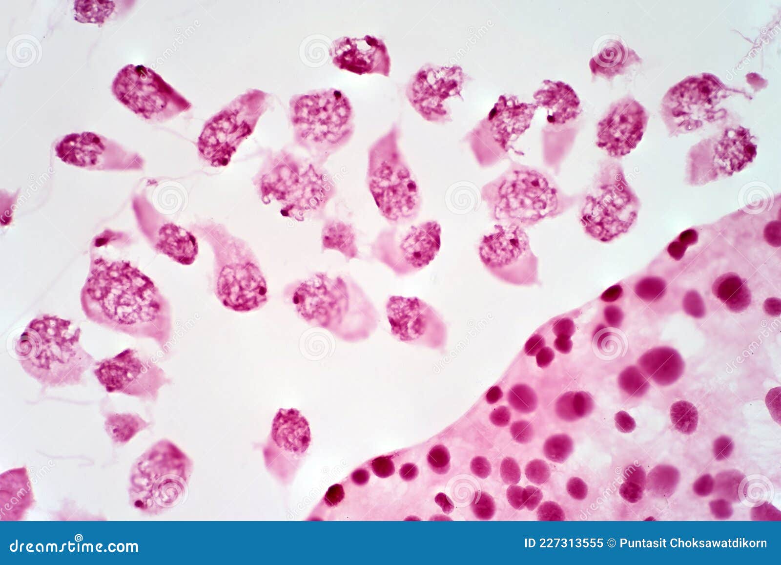 meiosis stages under microscope