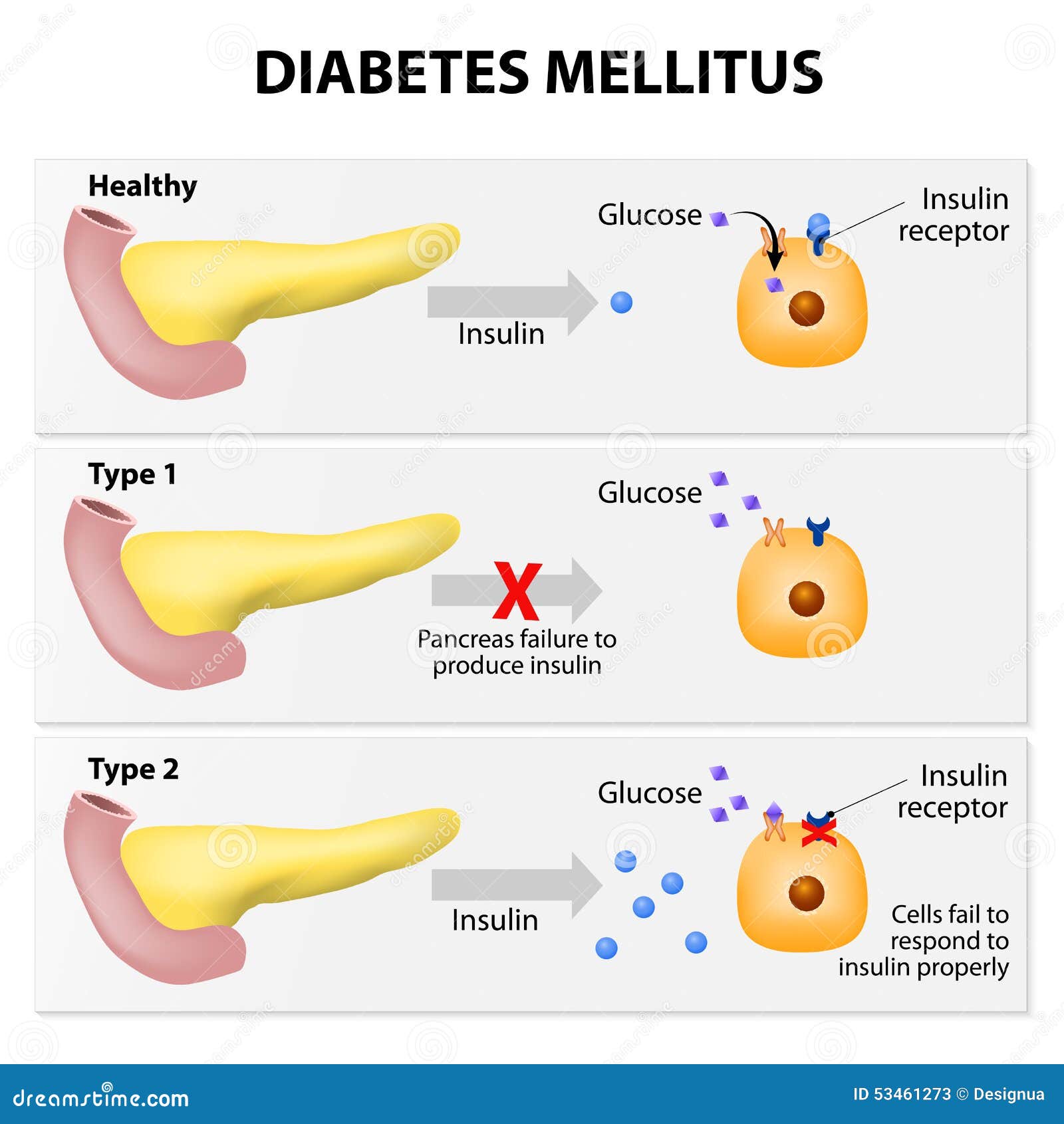 Tanda & Gejala Diabetes Mellitus - PENDIDIKAN PESAKIT Tanda & Gejala Diabetes Mellitus - PENDIDIKAN PESAKIT